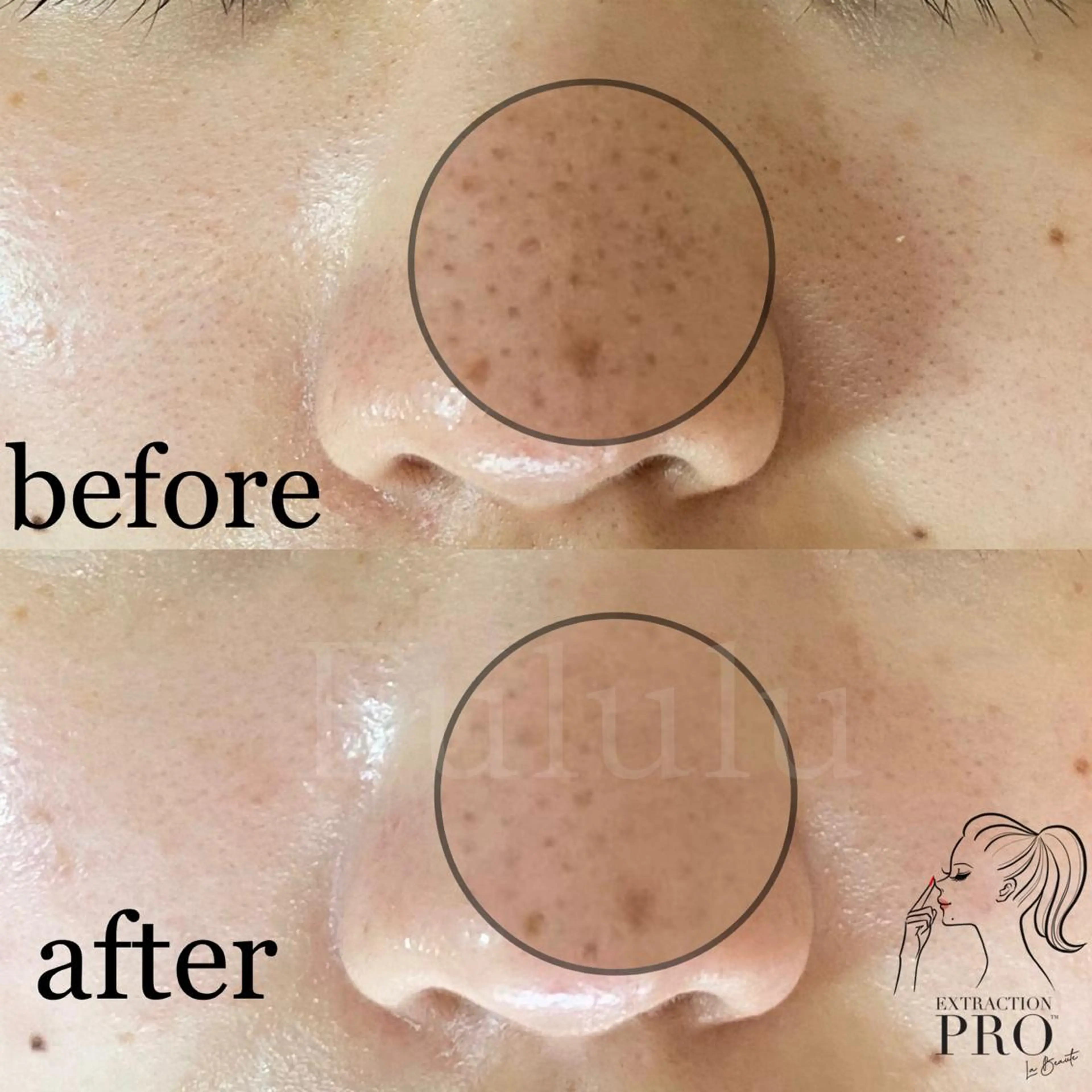 毛穴専門サロン　フルール所属・フルールFululu 自由が丘のエステ・リラクイメージ