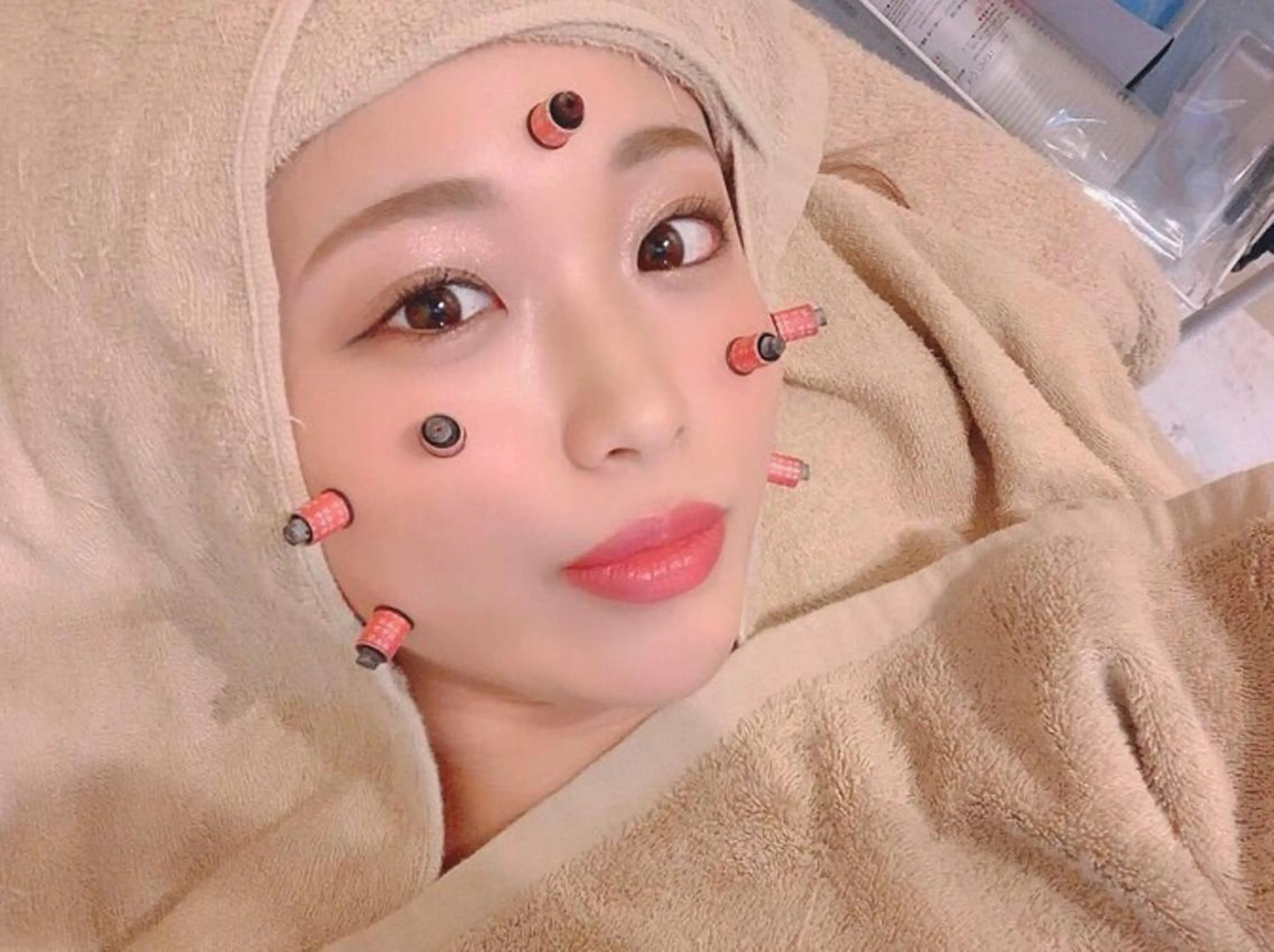 プレミアム美容鍼(小顔整体＋美容鍼＋炭酸ミスト＋美容灸)顔専用の美容灸で乾燥肌、潤い、毛穴引き締め。の写真