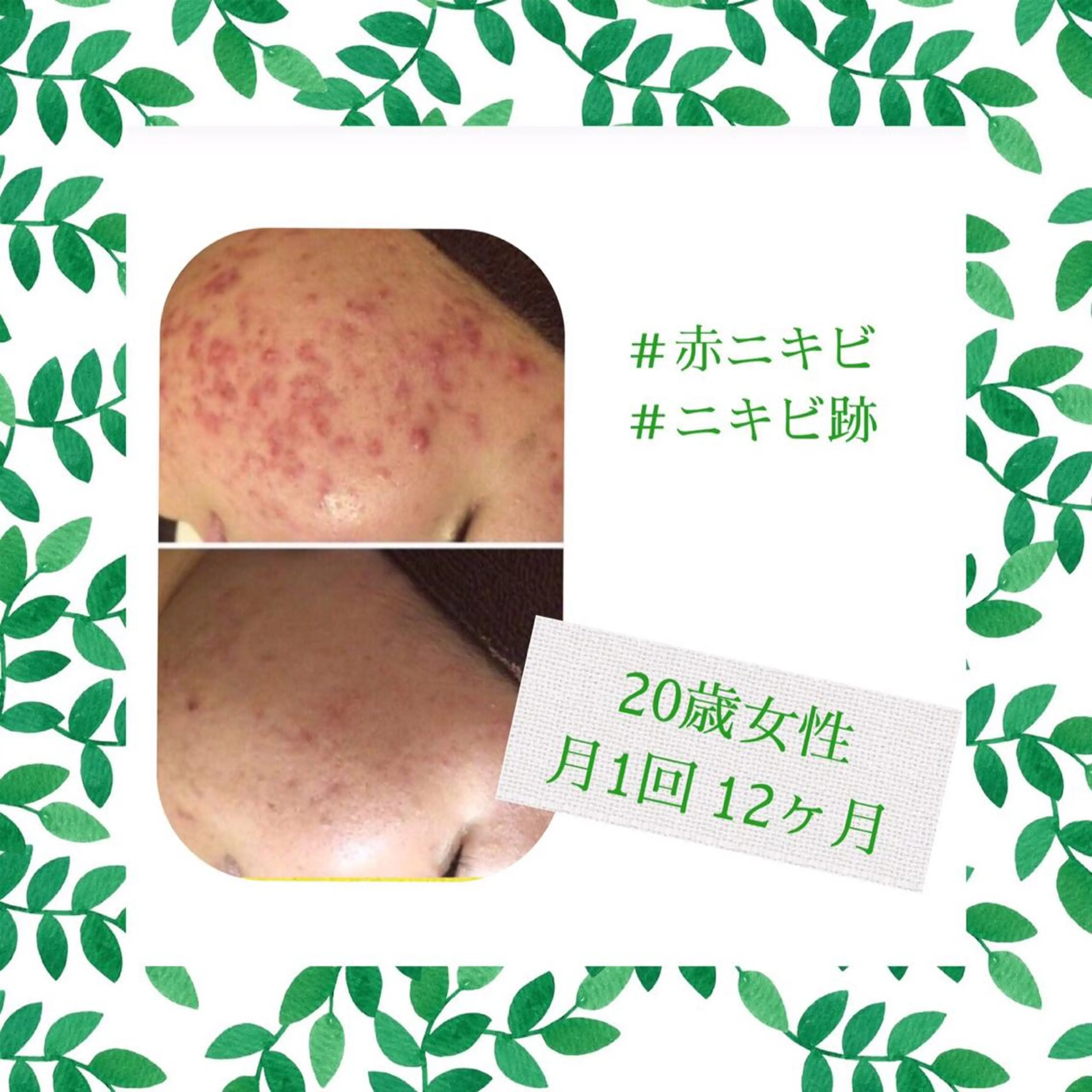 ミディアム カラー パーマ ヘアアレンジ メンズ キッズ ネイル マツエク・マツパ エステ リラク ニキビ・肌質改善専門 ♡人生が変わるサロンのエステ・リラクイメージ