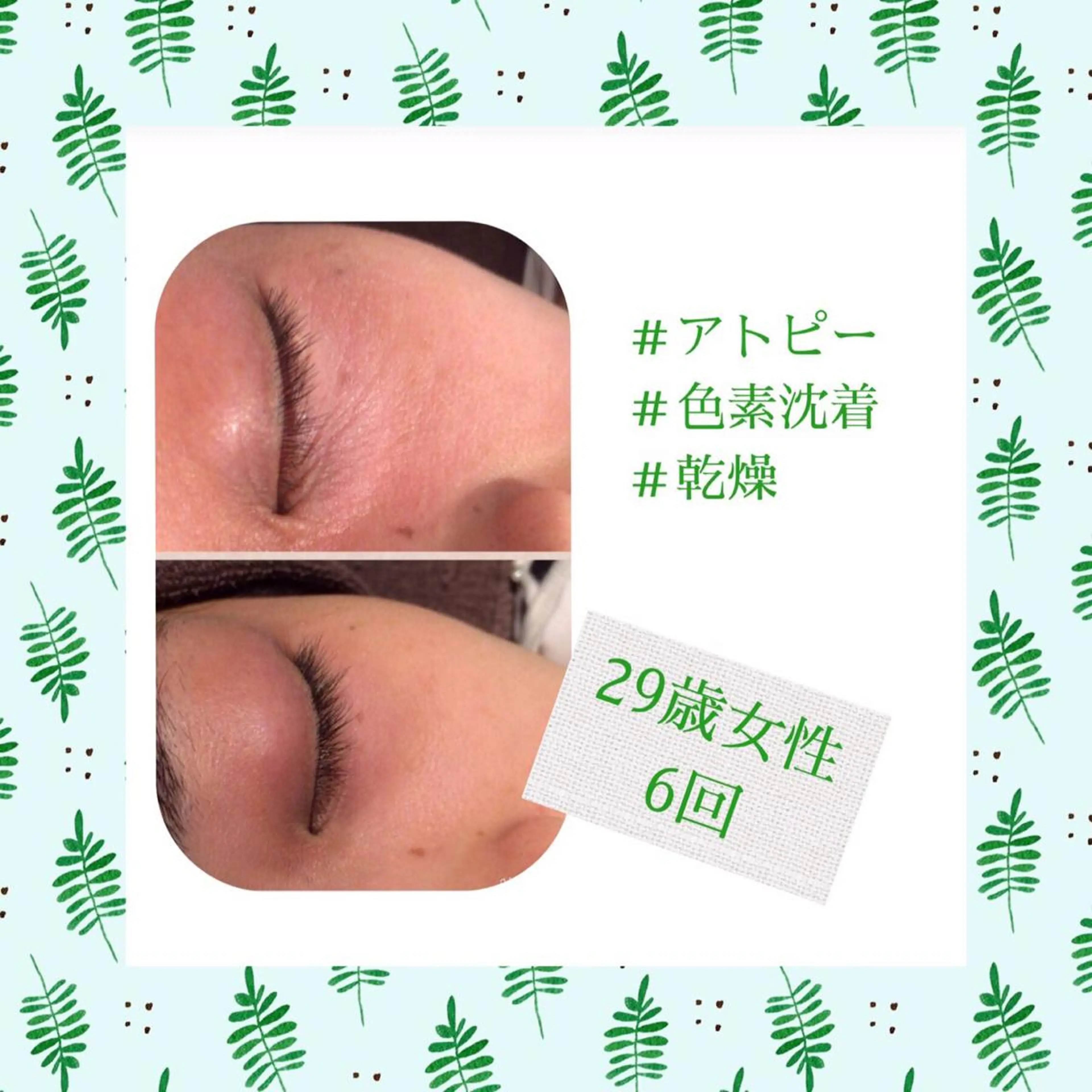 ミディアム カラー パーマ ヘアアレンジ メンズ キッズ ネイル マツエク・マツパ エステ リラク ニキビ・肌質改善専門 ♡人生が変わるサロンのエステ・リラクイメージ