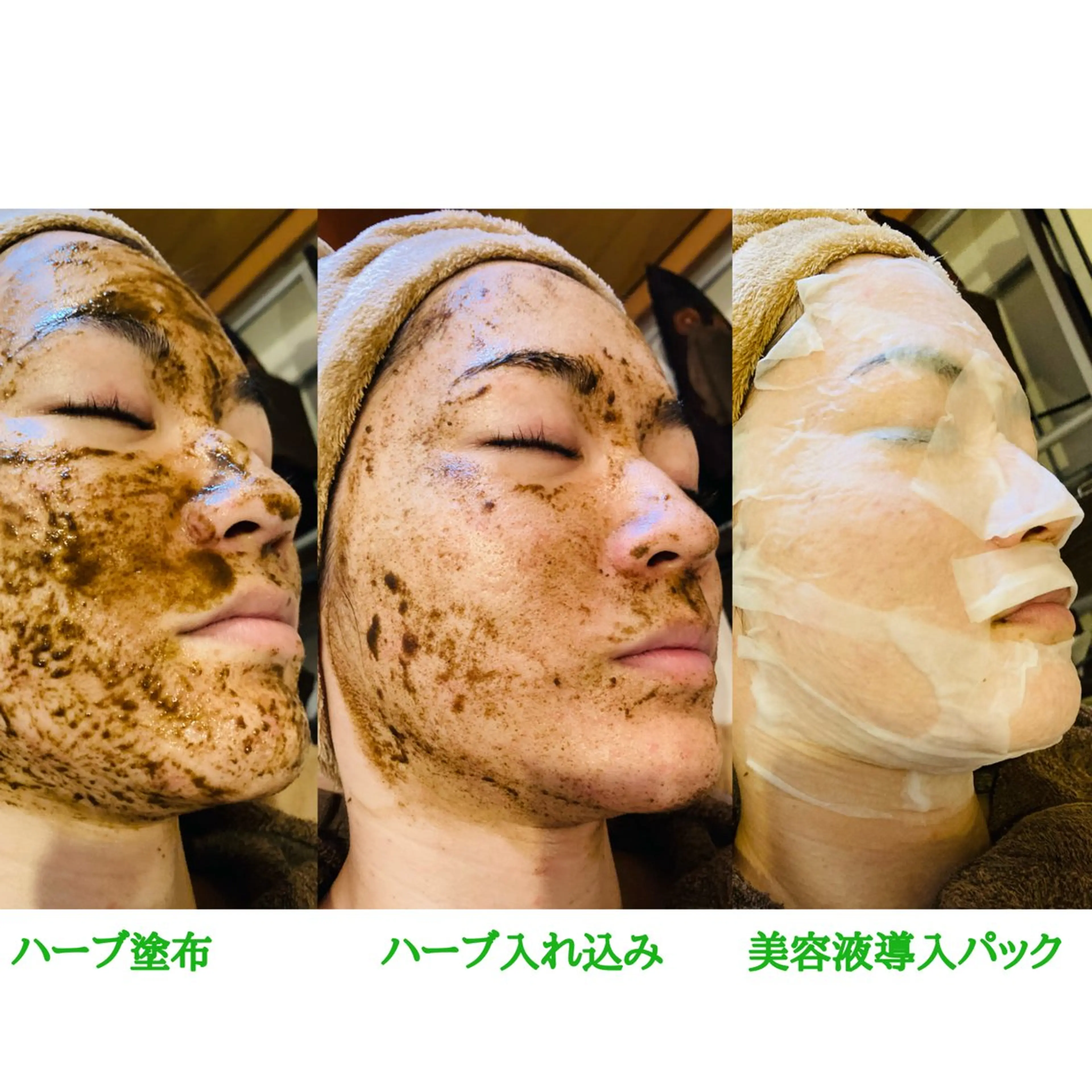 《剥離なし・国産ハーブ使用》肌育×小顔矯正で透明感あふれる艶肌小顔♪の写真