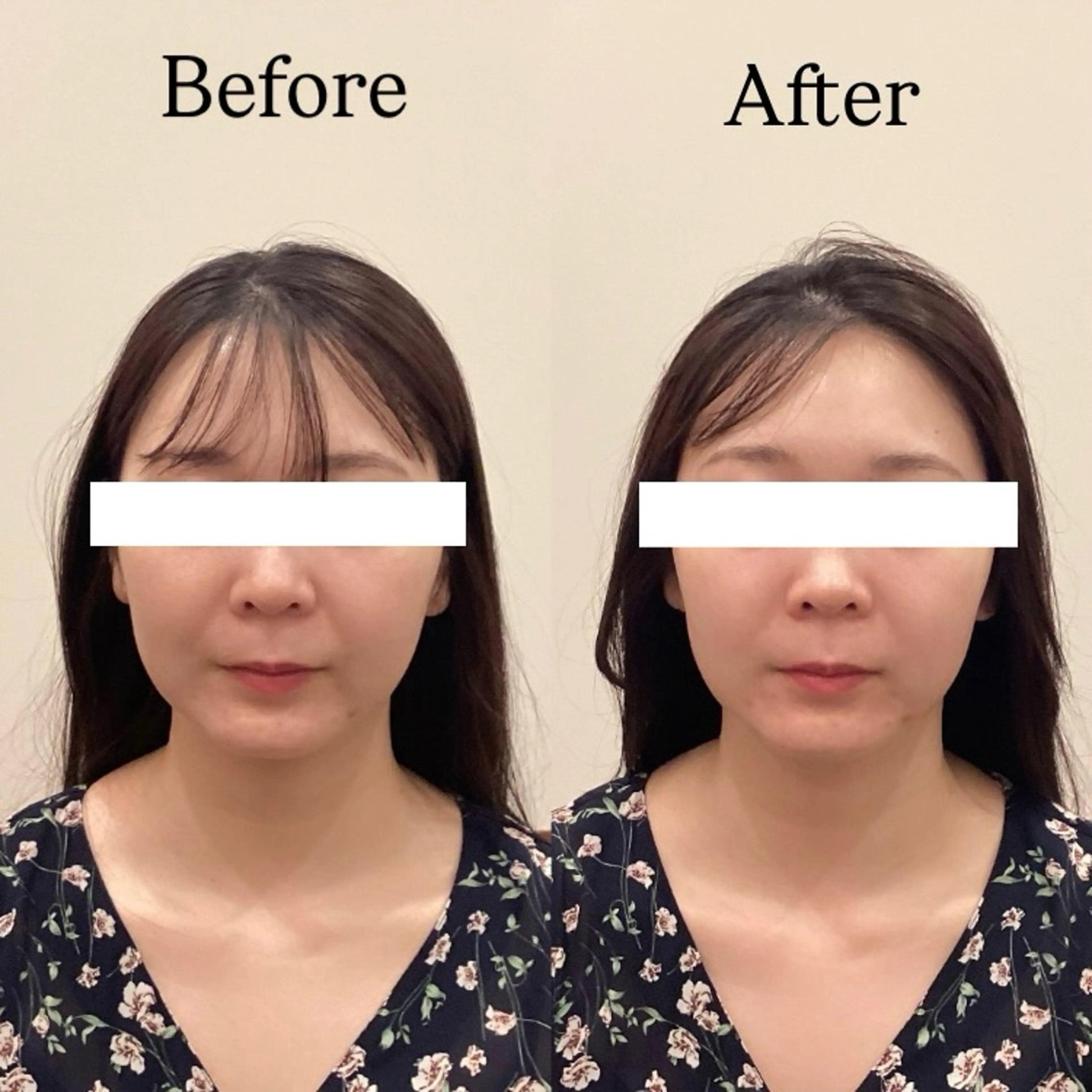 Hari Lounge恵比寿所属・chika🦋 ハリラウンジ恵比寿のエステ・リラクイメージ