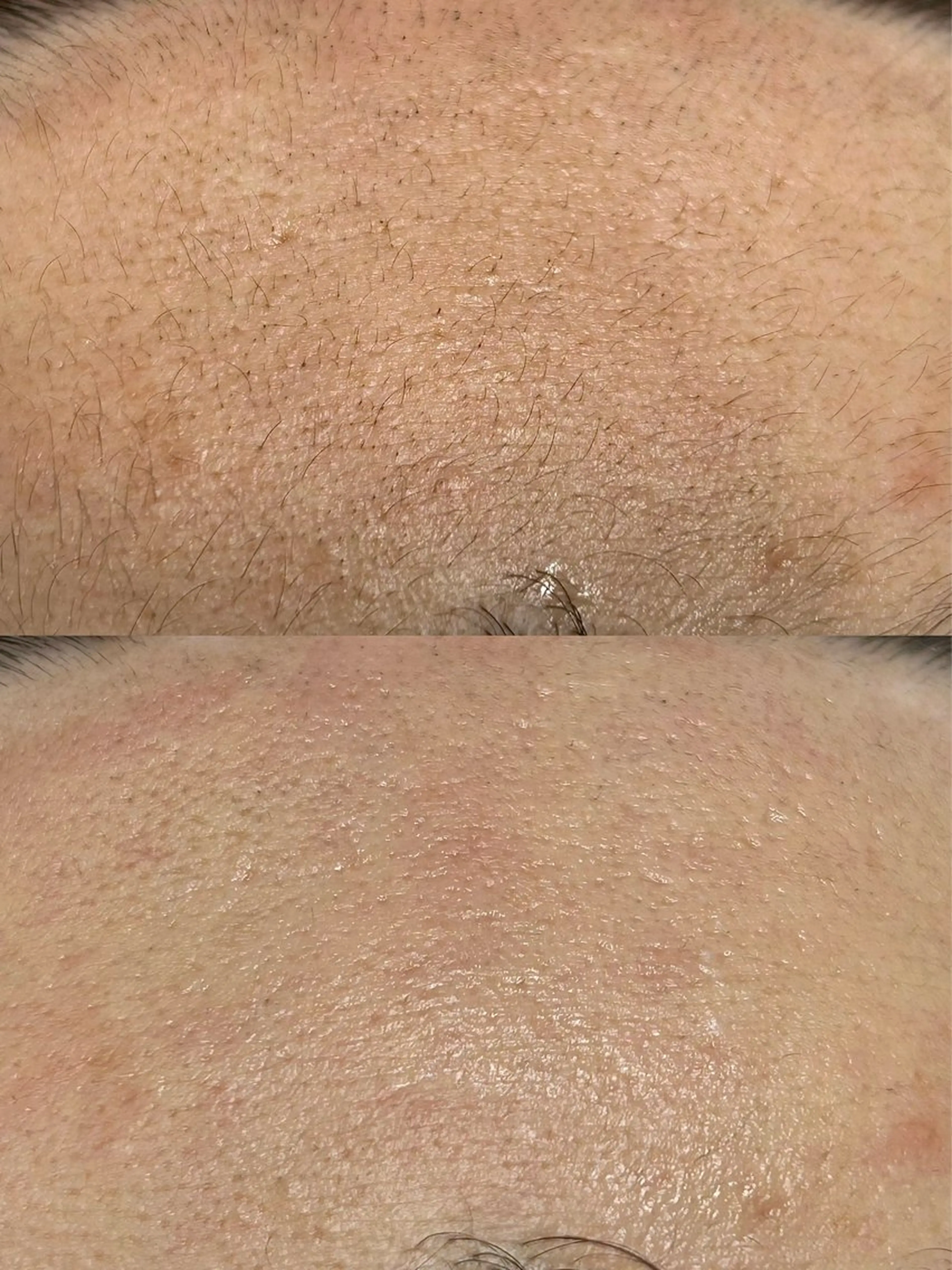 エステ 浦添 Le’a【レア】のマツエク・マツパデザイン