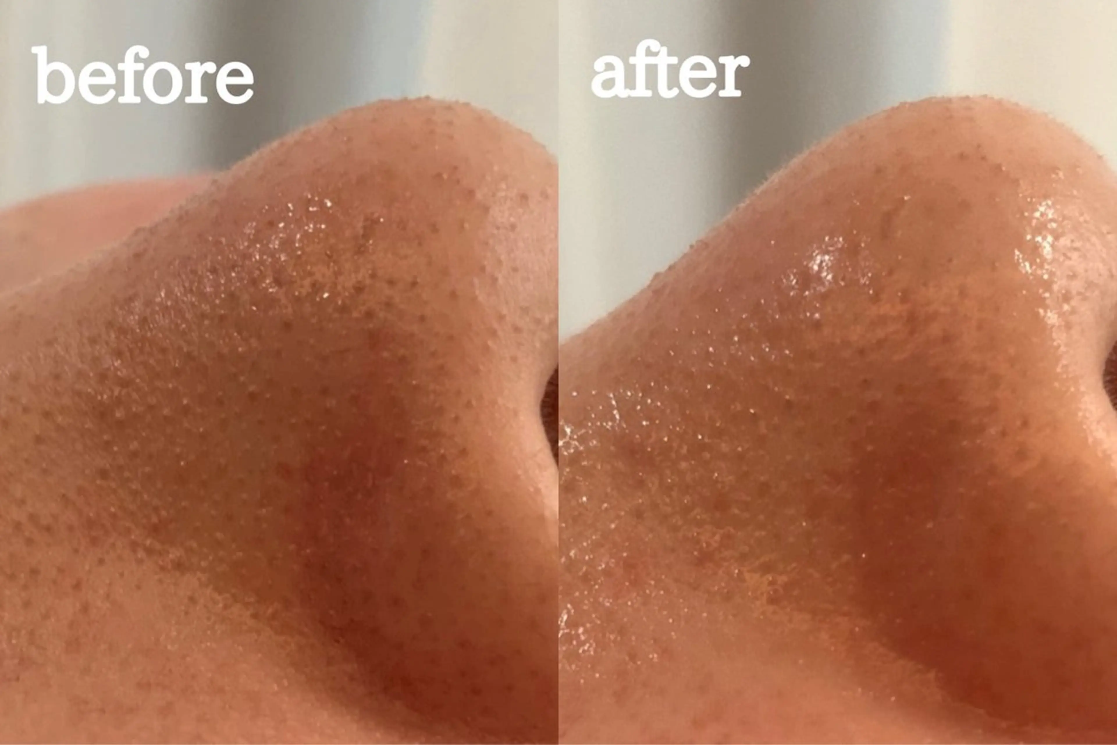 最速小顔・肌質管理 espoirマキのエステ・リラクイメージ