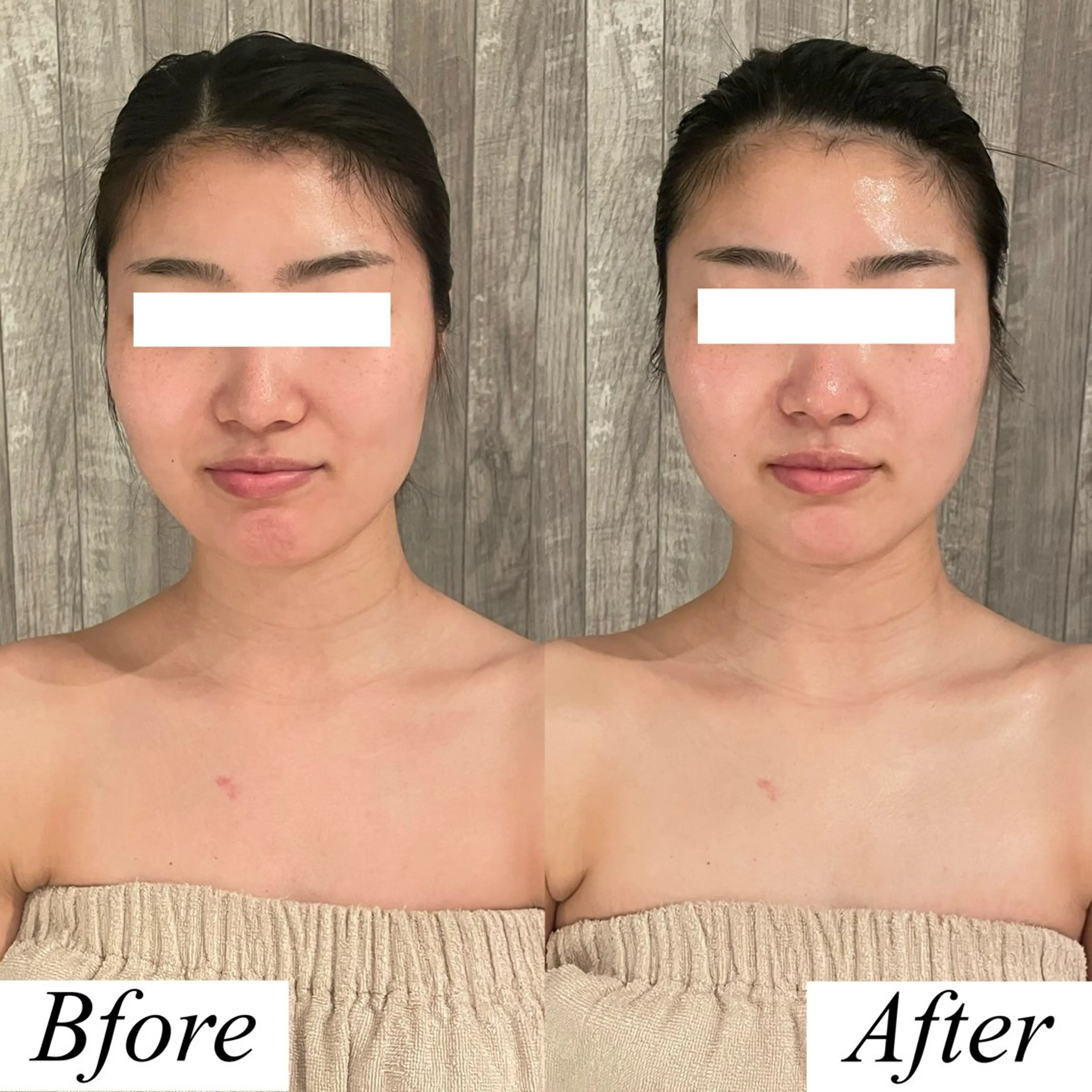 グレースフィオーレ上野御徒町店所属・頭蓋骨小顔矯正 上野御徒町店＊かんなのエステ・リラクイメージ