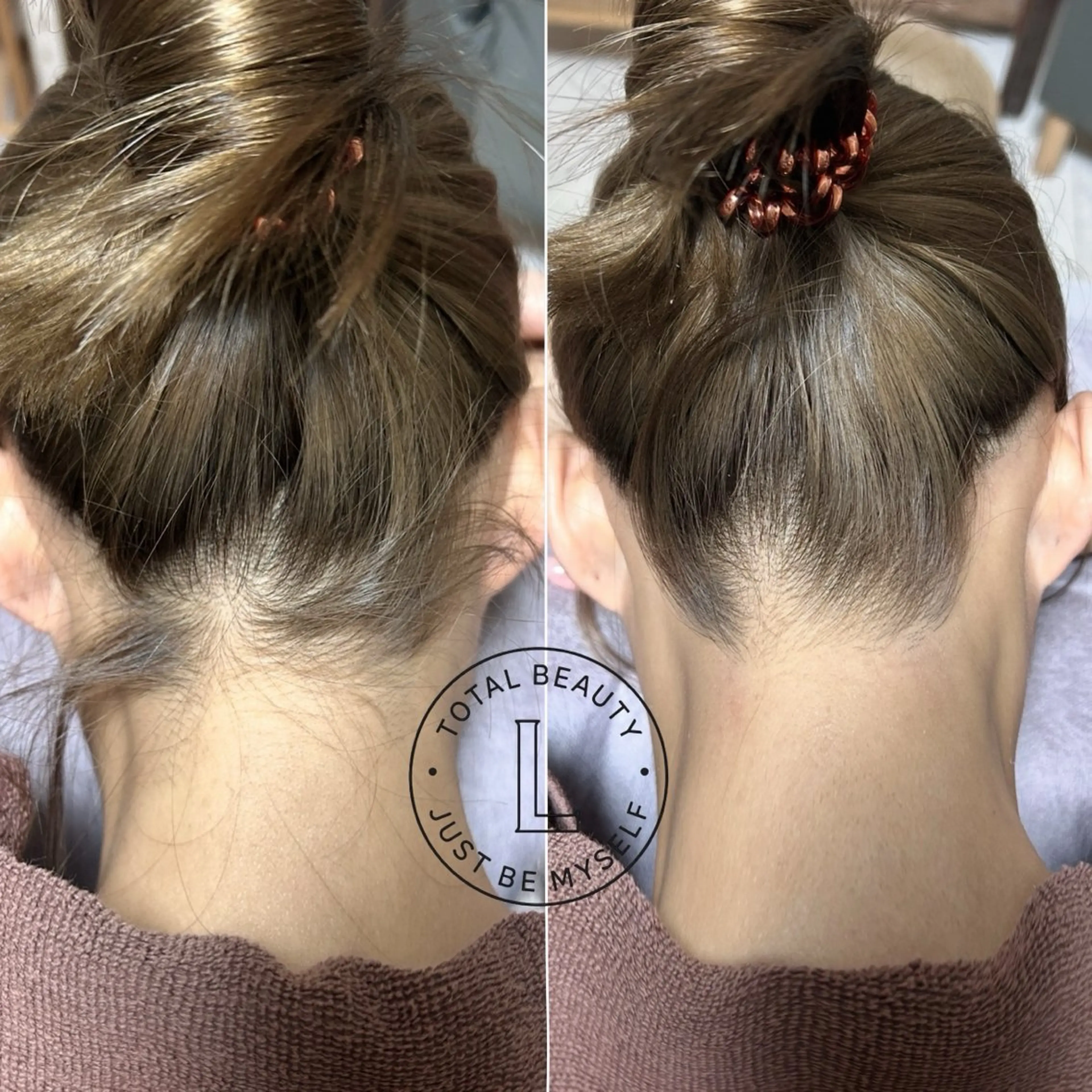 脱毛サロンLULA 恵比寿店　笠松のエステ・リラクイメージ