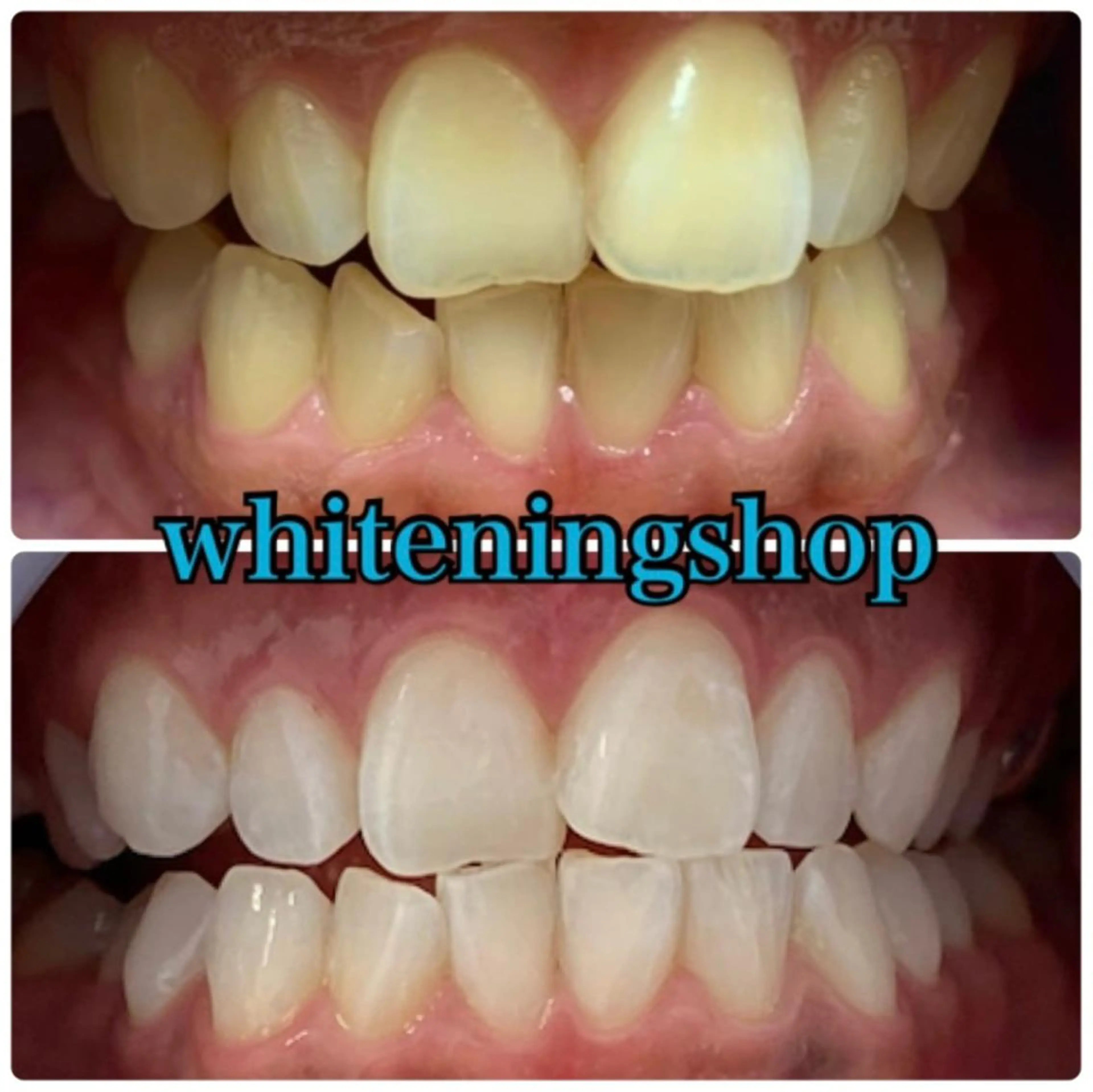 ホワイトニング ショップ吉祥寺店のエステ・リラクイメージ