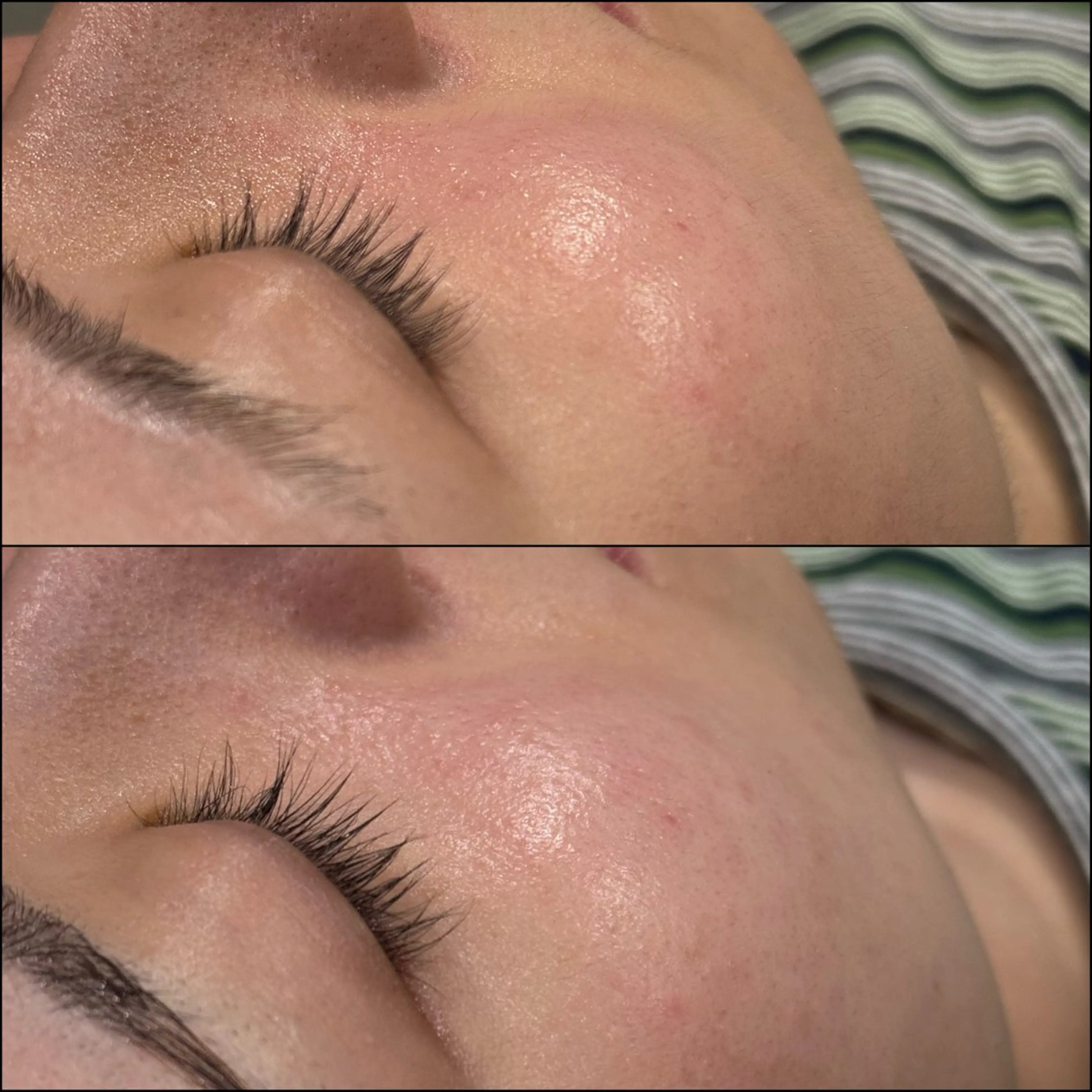 脱毛 LiZA エステティックサロンのエステ・リラクイメージ