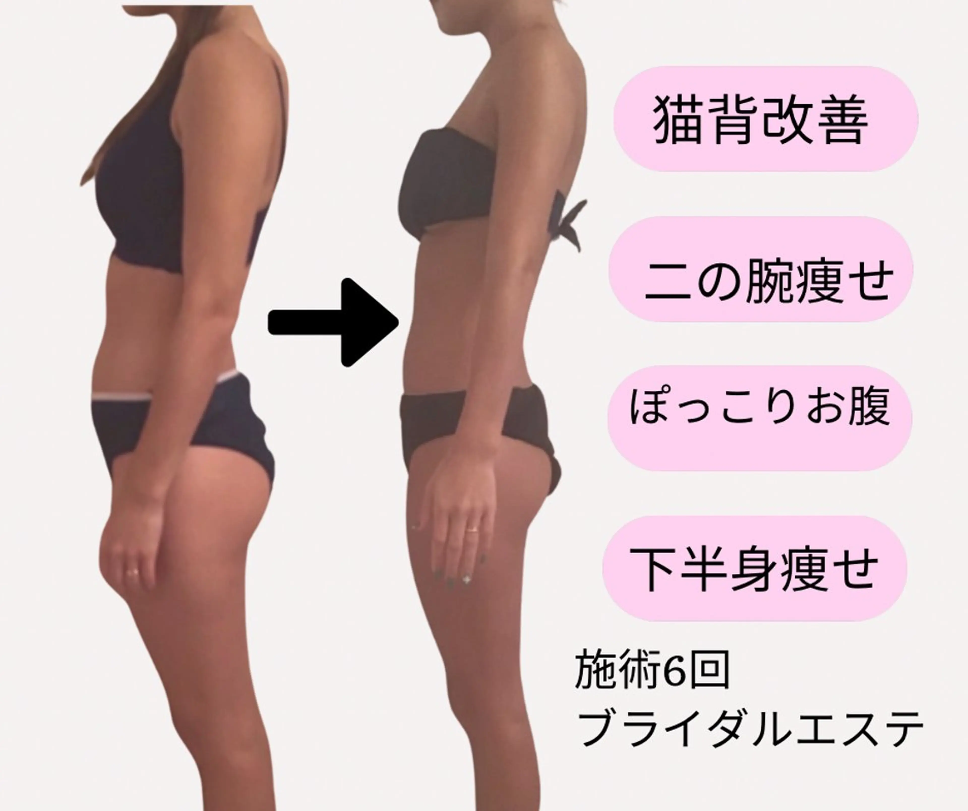 人気No1スーパーモデル級美ボディ90分　　　　　　　美容整体×エステ筋膜・肩甲骨はがし・骨盤肋骨矯正の写真