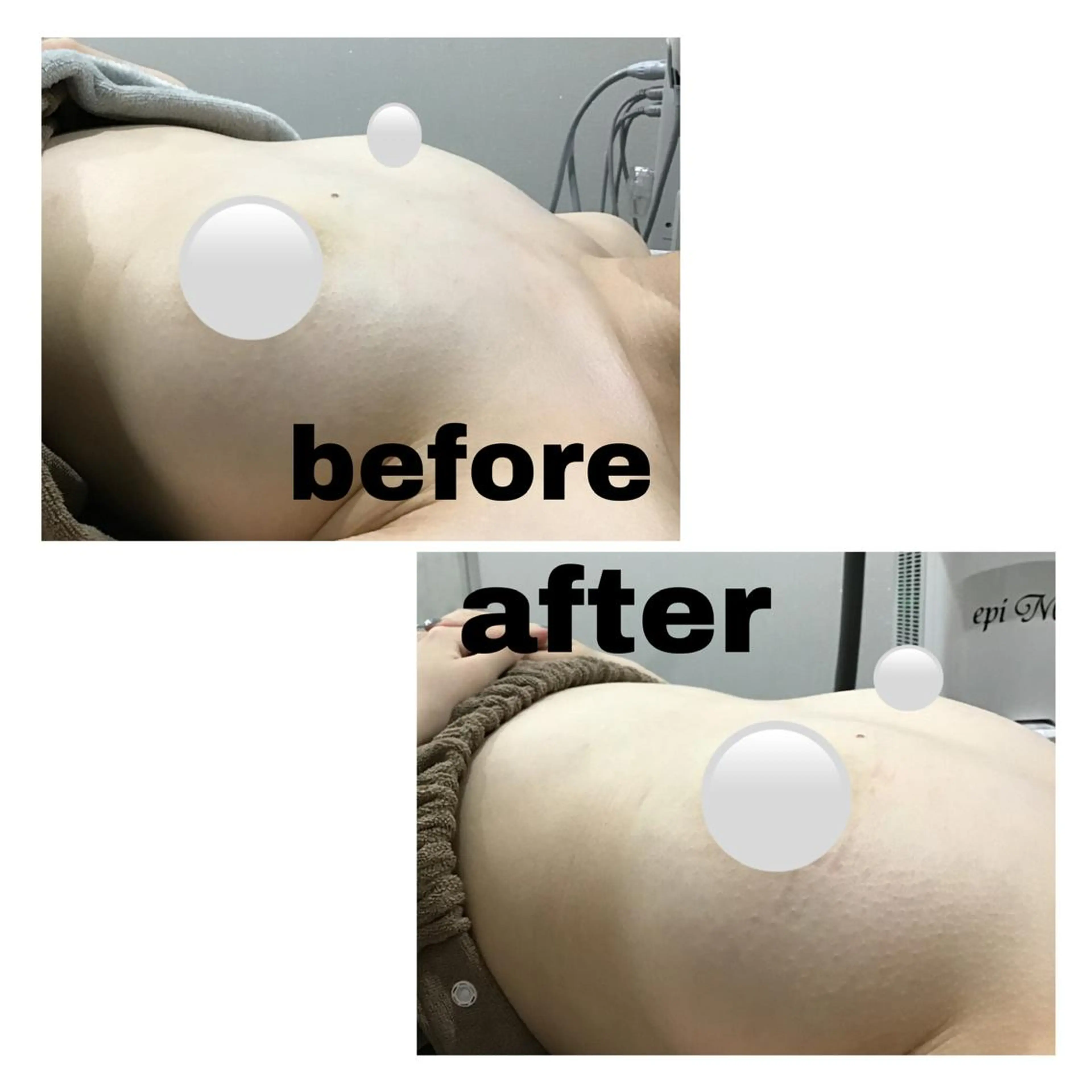 アルカンジュ~archange~所属・痩身/毛穴洗浄/脱毛 アルカンジュのエステ・リラクイメージ