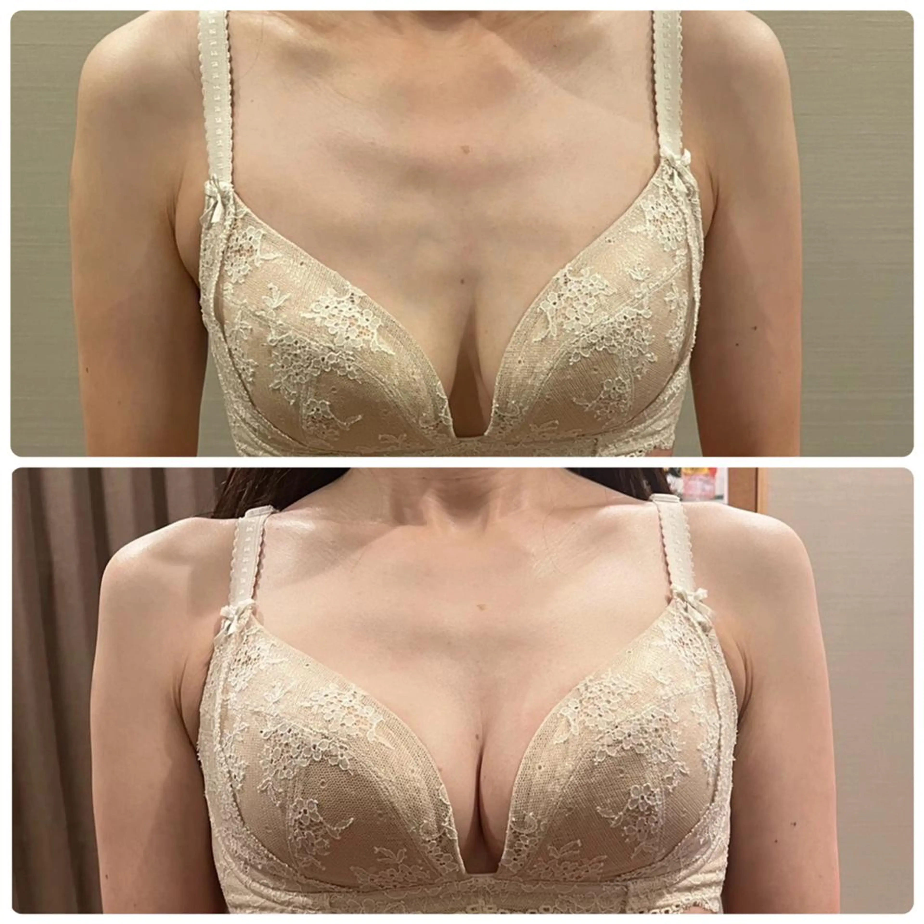 3名様限定✨体の温め&電気&マッサージで悩み改善✨冬はバストケアをする絶好のタイミング✨上半身痩せお任せ下さい😊の写真