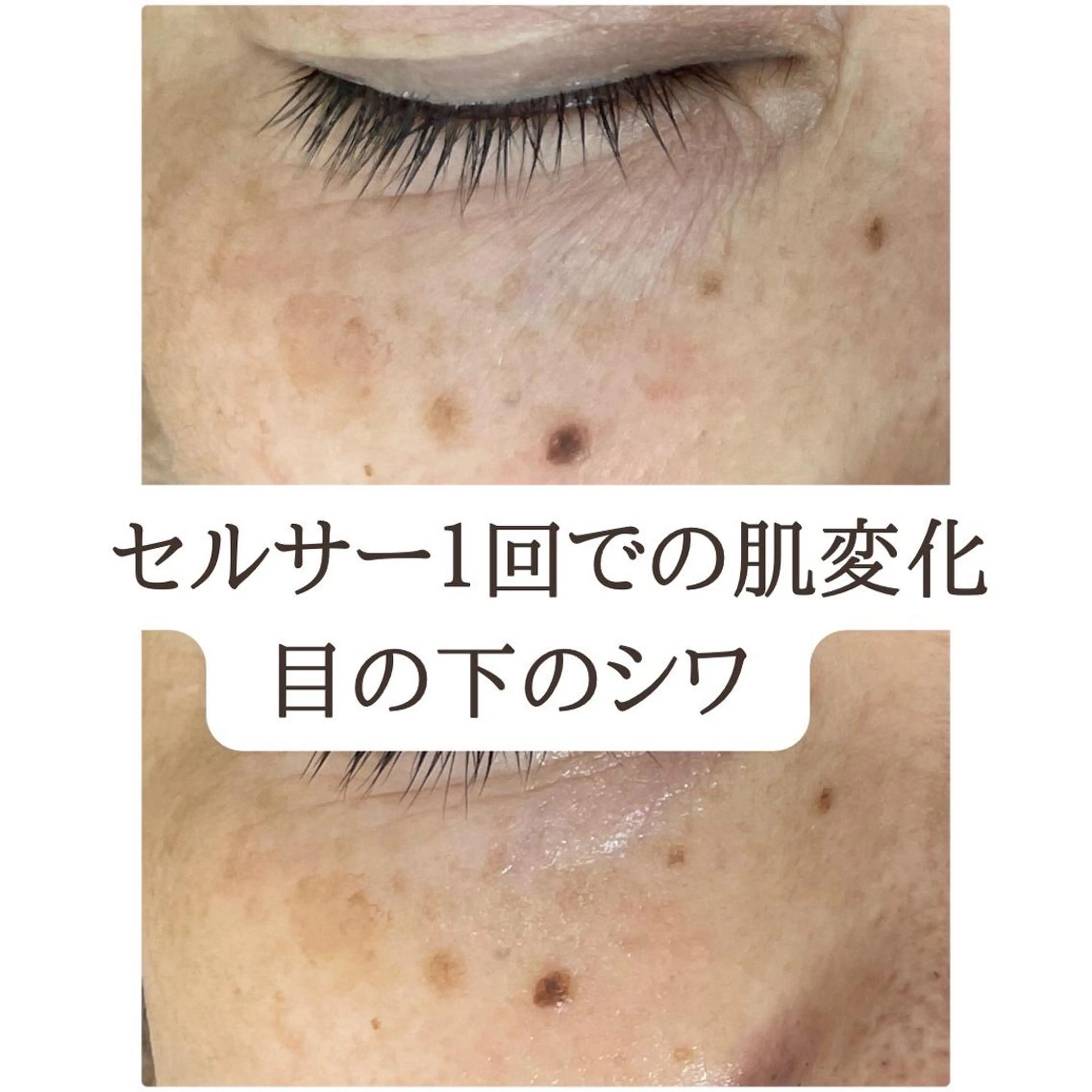 都度払い 肌質改善専門サロンのエステ・リラクイメージ