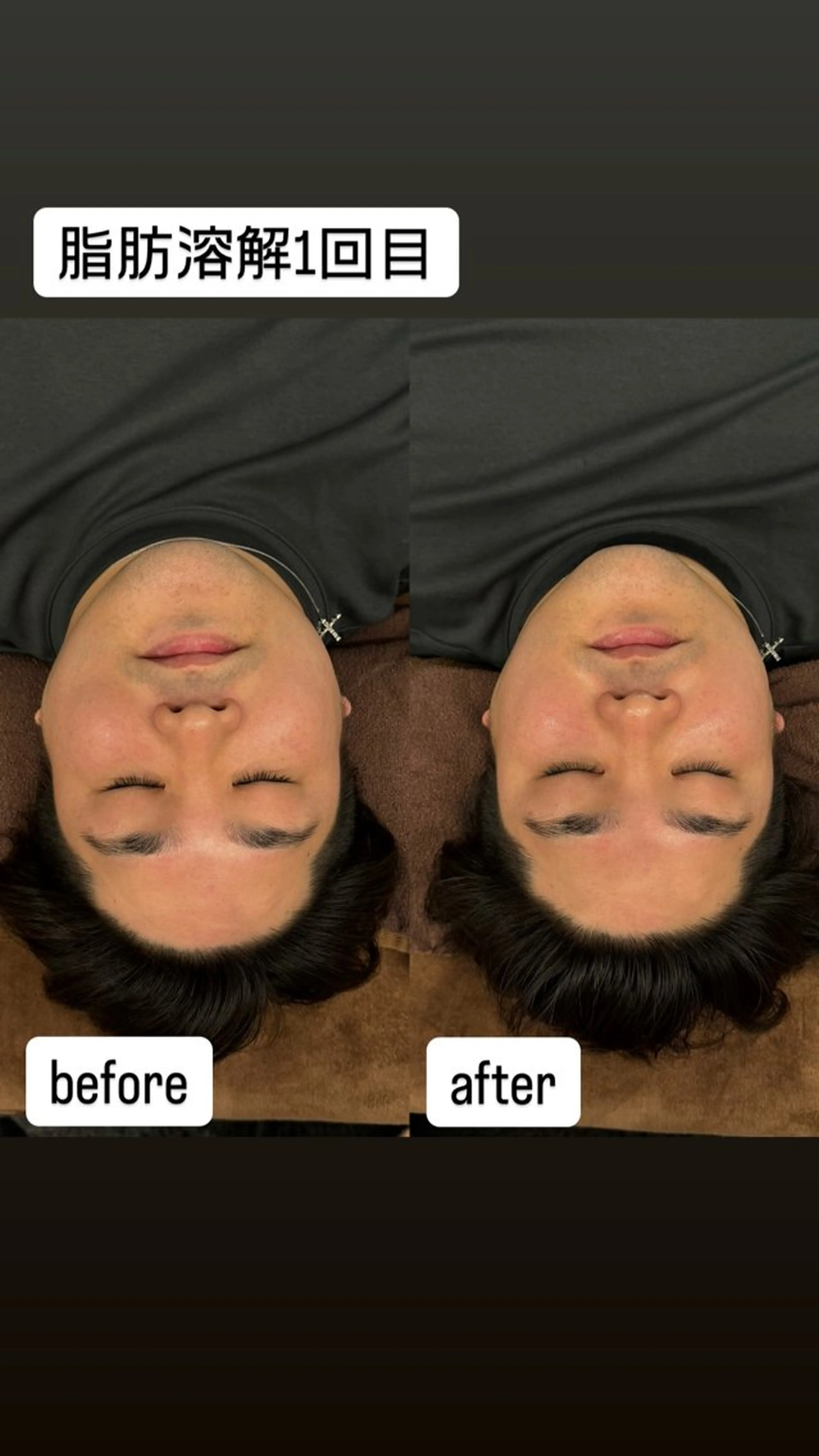 エステ Micell beauty所属・Micell beautyのエステ・リラクイメージ