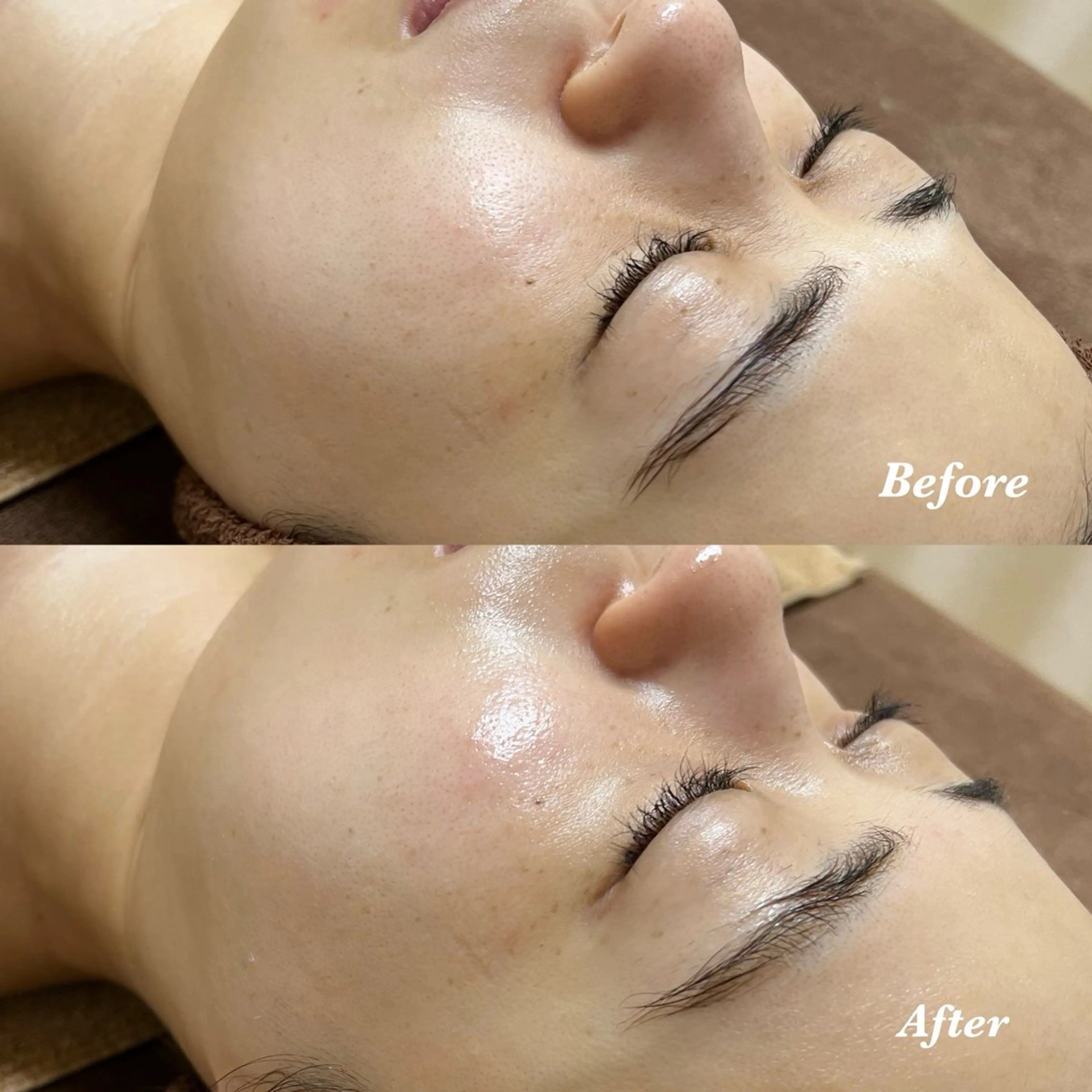 エステ 𝐌𝐚𝐜𝐡𝐞 𝐛𝐲 𝐌𝐚𝐲𝐮所属・ハーブピーリング🌿 𝑴𝒂𝒚𝒖のエステ・リラクイメージ