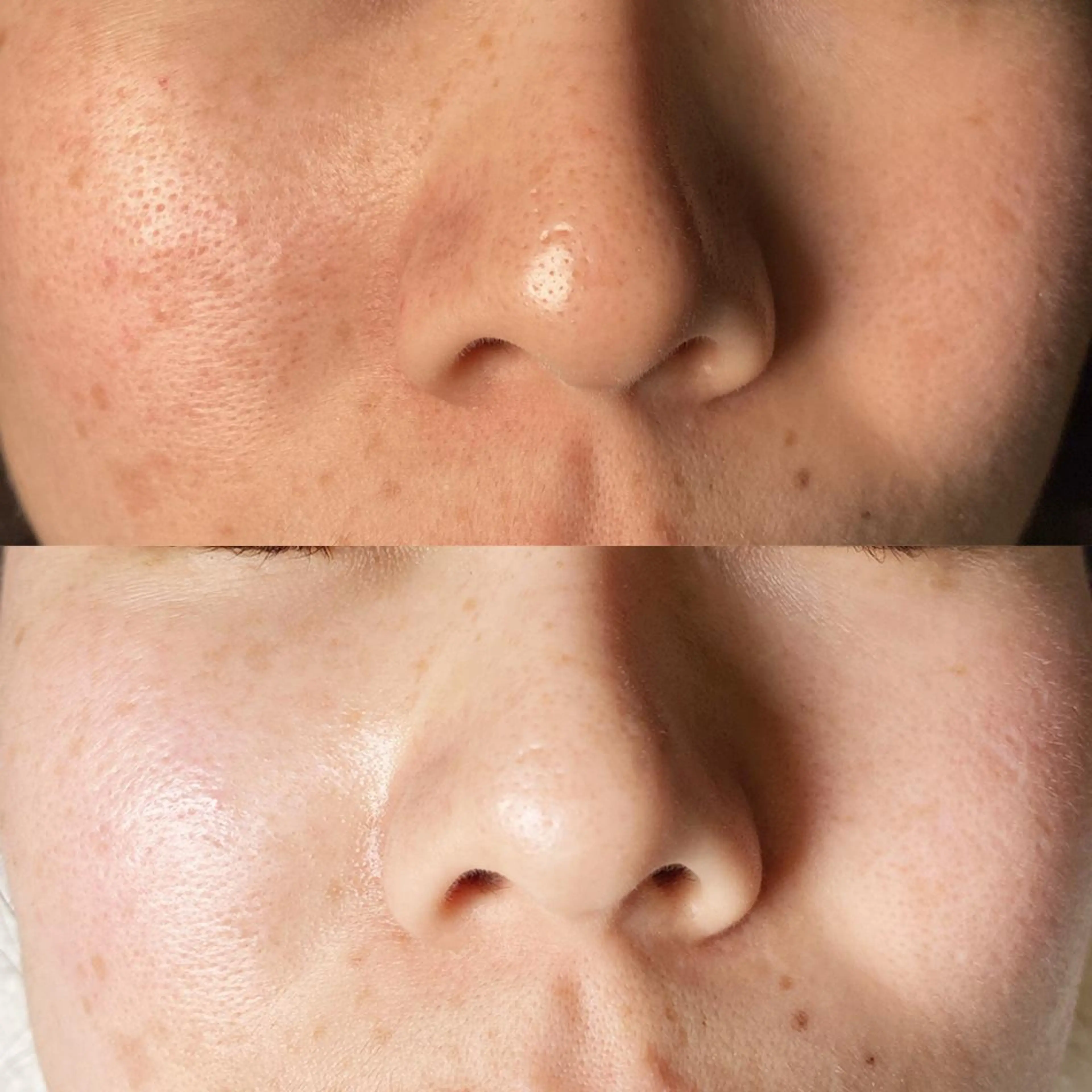 Monreve所属・美人スイッチdiet スーパージェクションのその他イメージ