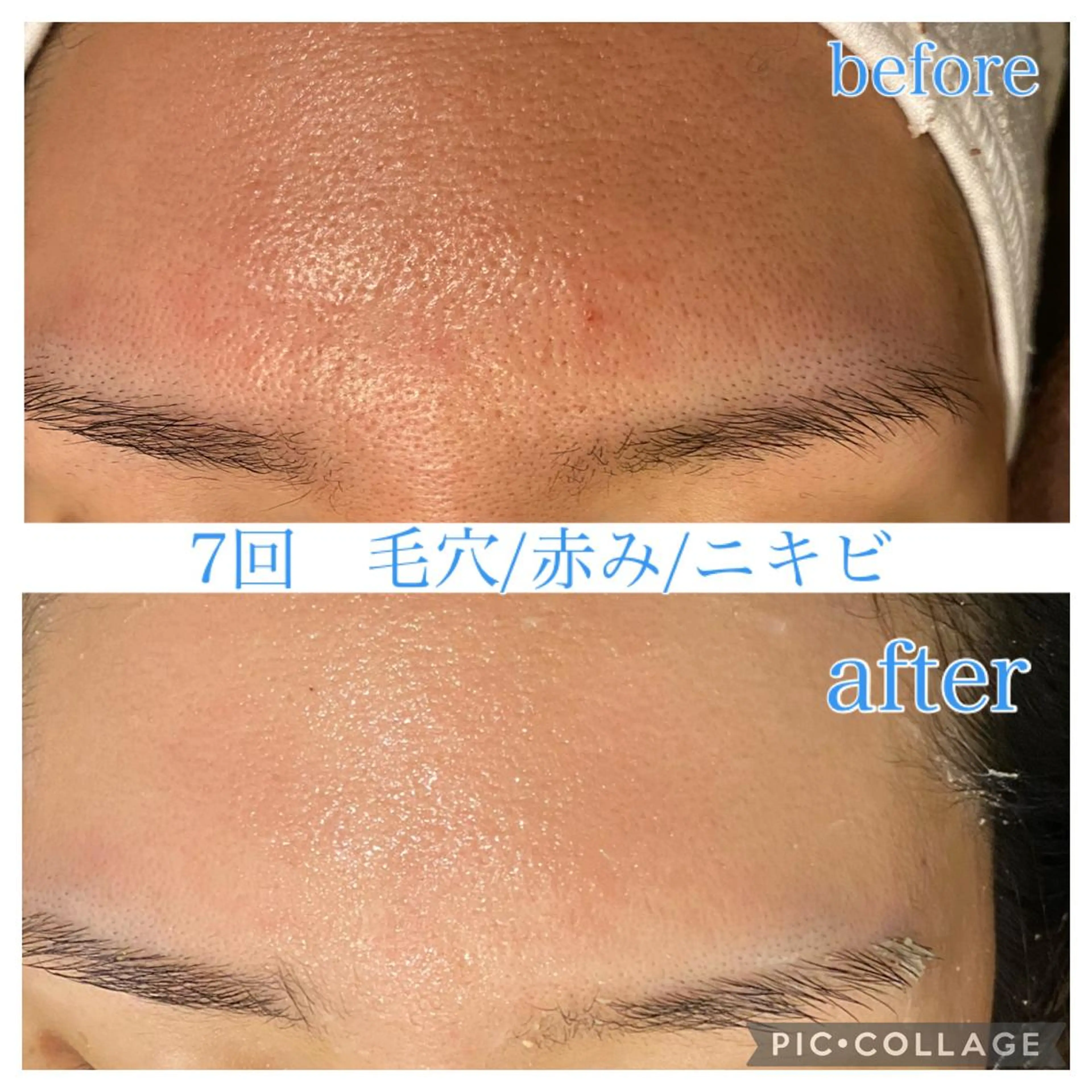 ショート カラー パーマ ヘアアレンジ メンズ ネイル マツエク・マツパ エステ リラク Ensor Clair所属・EnsorClair 代表　野口真央のエステ・リラクイメージ