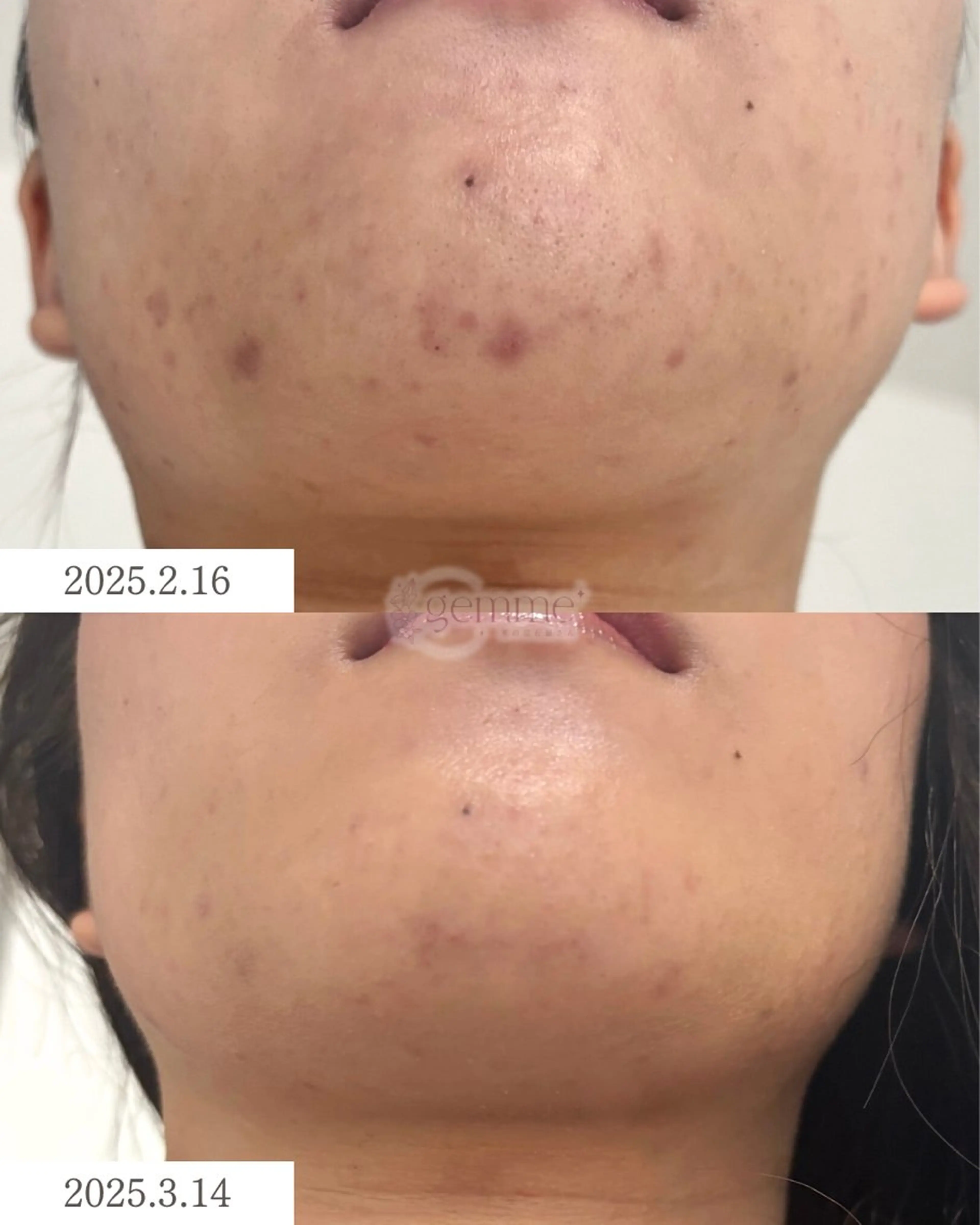 エステ リラク 美の宝石屋さん gemme【ジェム】所属・gemme -ジェム-のエステ・リラクイメージ