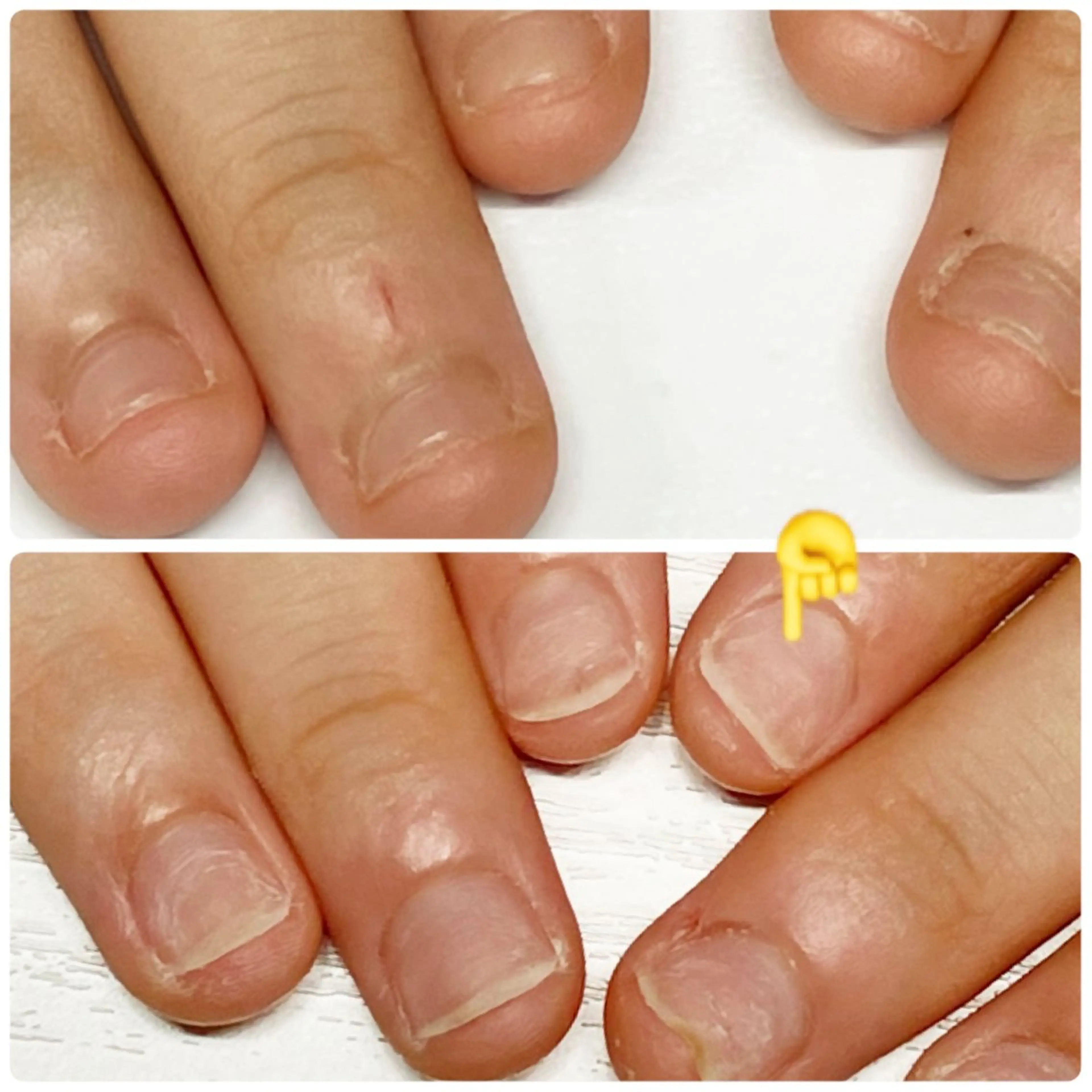 深爪ケア施術✨自爪風仕上げの写真