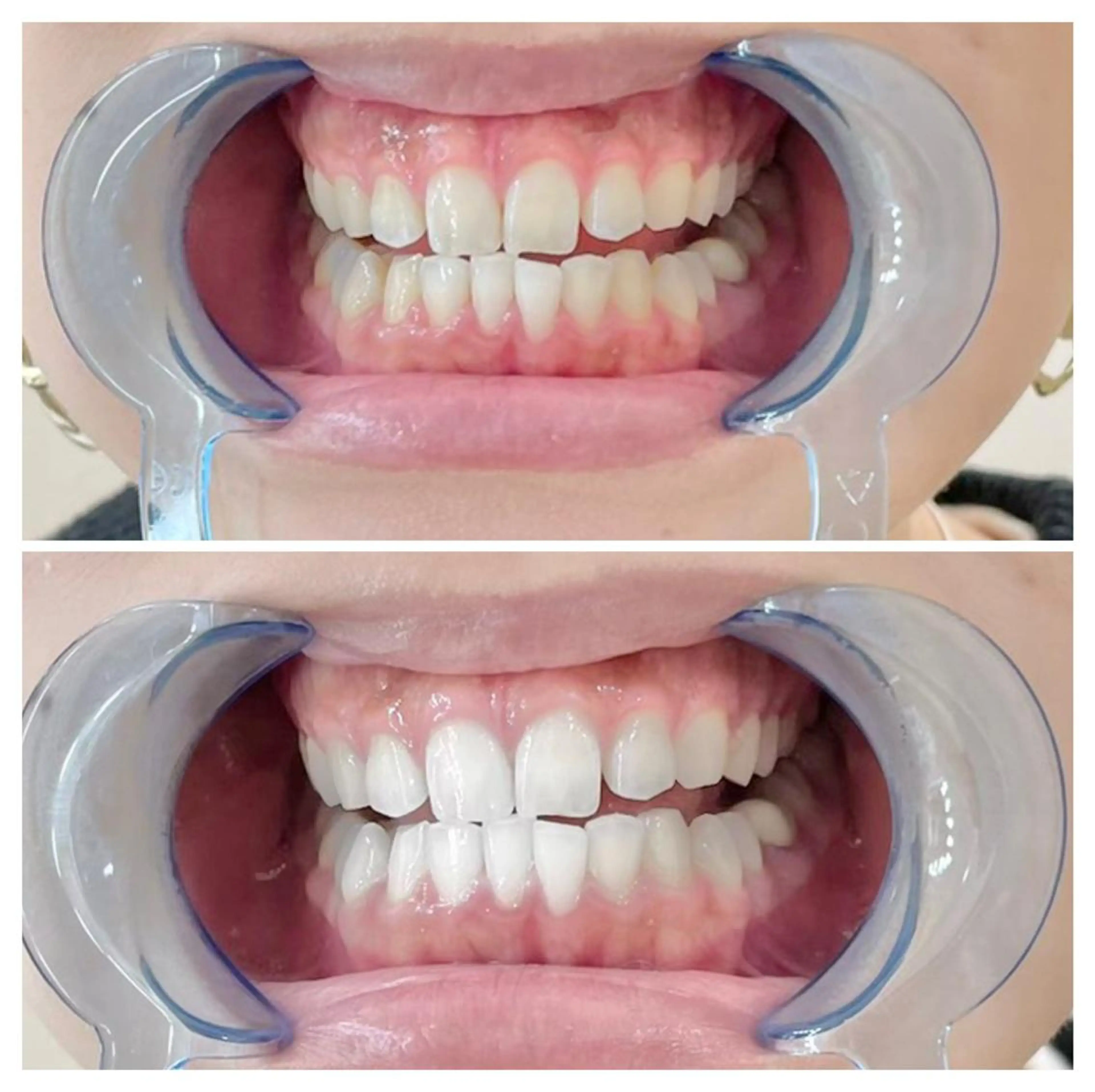 ロング ヘアアレンジ ネイル マツエク・マツパ メンズ カラー パーマ キッズ アイブロウ エステ リラク ライトビューティー 銀座店のエステ・リラクイメージ