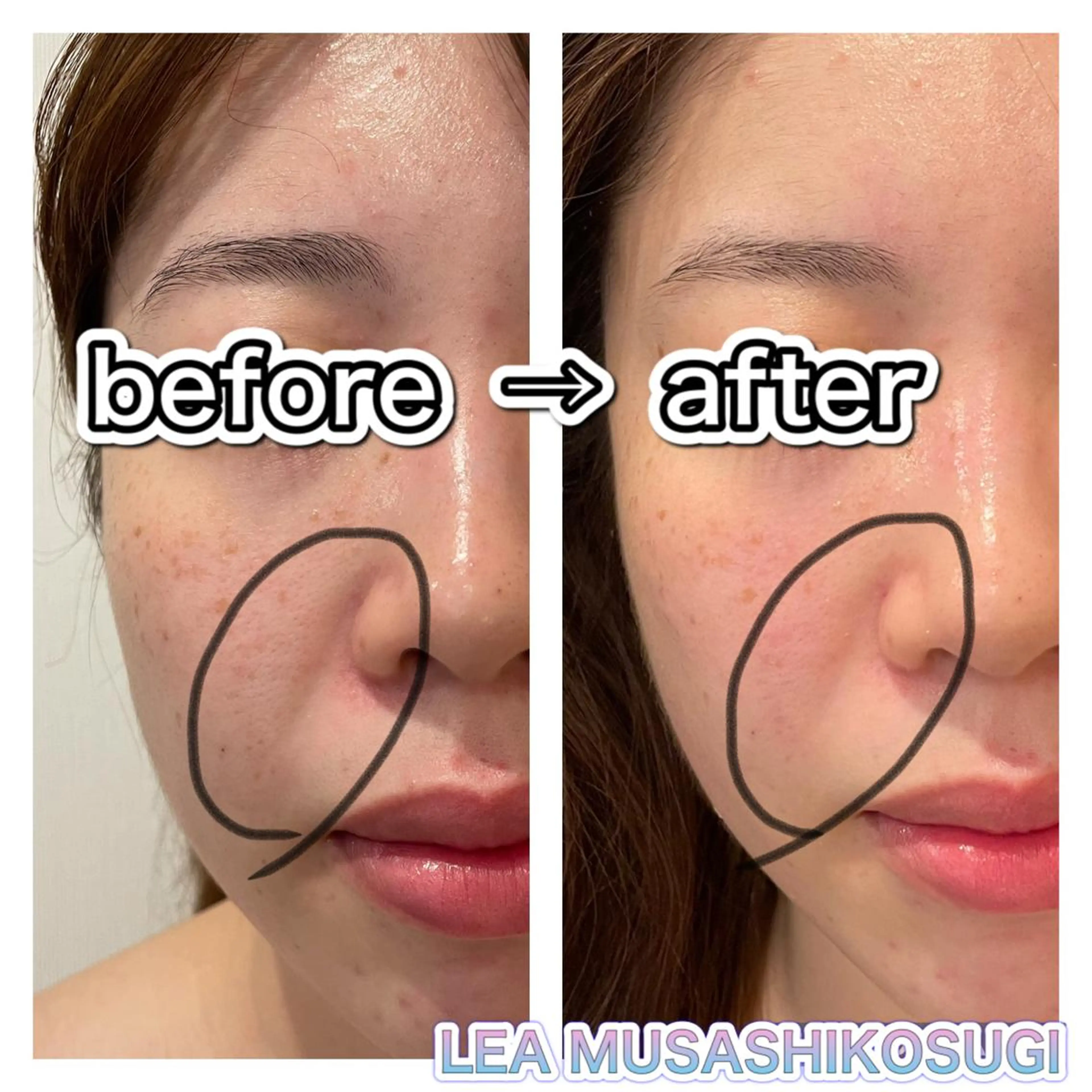 LEA MUSASHIKOSUGI所属・美肌育成サロン LEA武蔵小杉のエステ・リラクイメージ