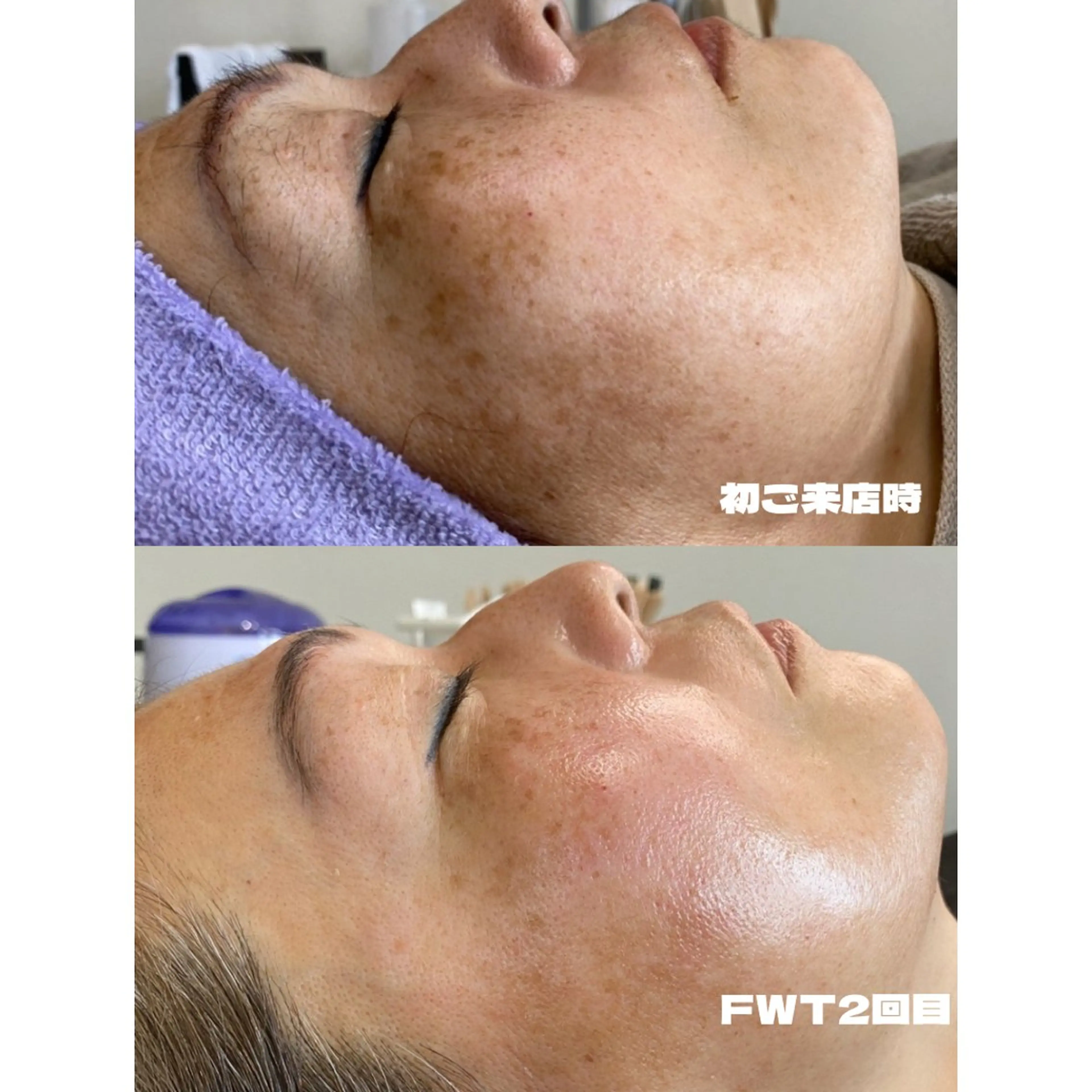 エステ デコパーツが得意♪ ネイル/眉毛/エステの眉毛・アイブロウイメージ