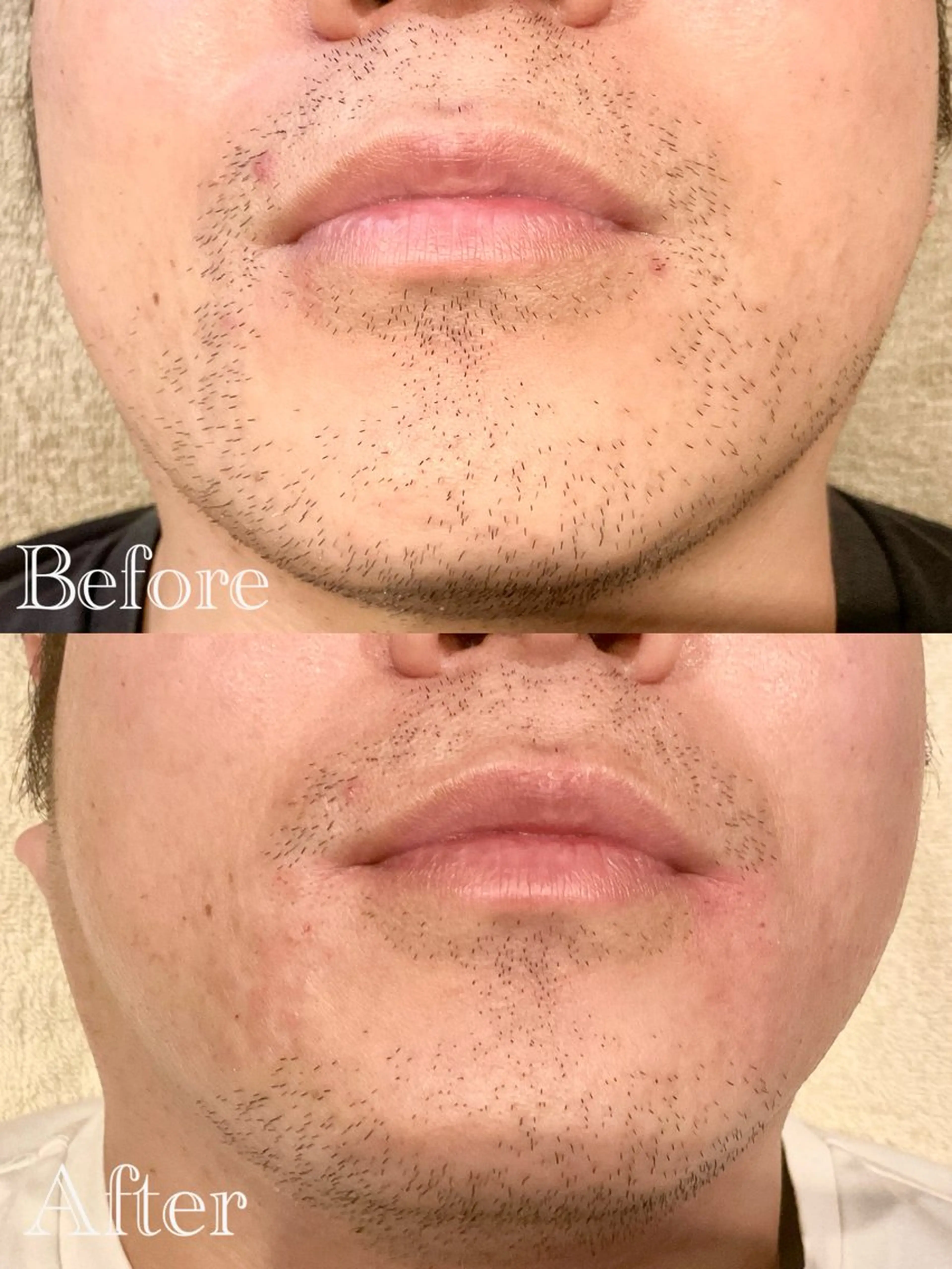 メンズ 脱毛 沖 美麗のエステ・リラクイメージ