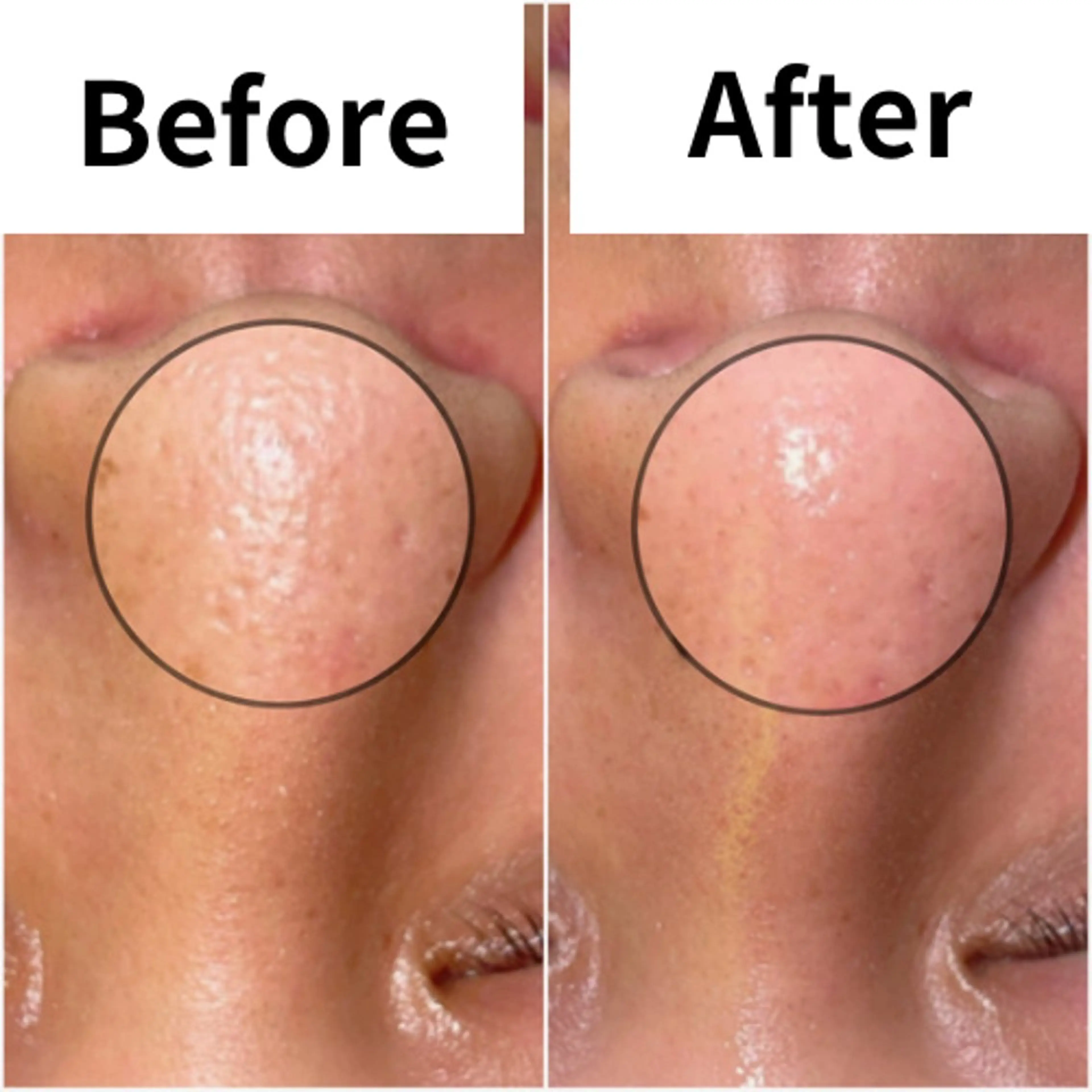 エステ SELF  BEAUTY gracia浦添店所属・gracia 浦添店のその他イメージ