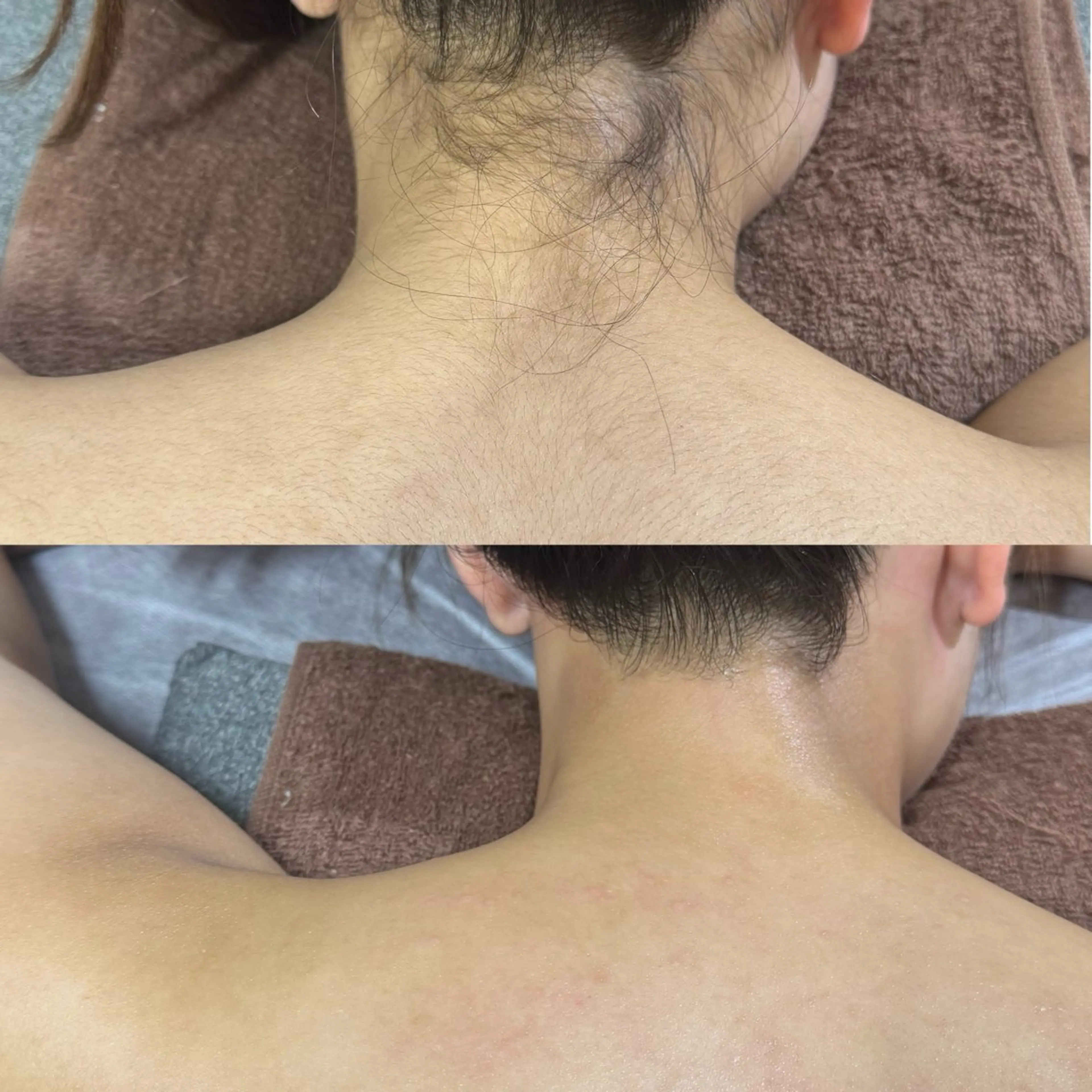 背中＋うなじワックス脱毛🎀 後ろ姿美人🩰【オフショル/ドレスアップ/イベント前におすすめ】の写真