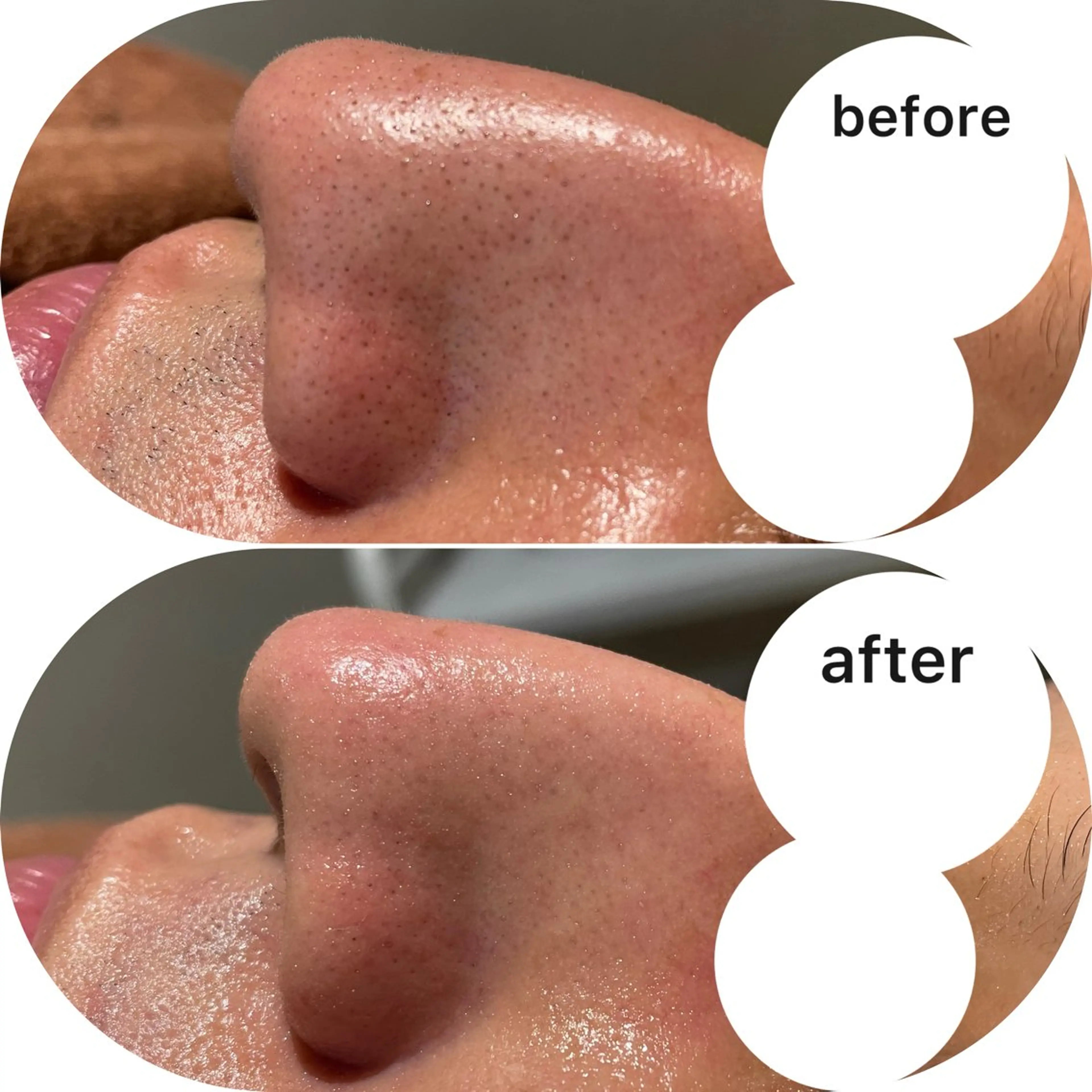 エステ 脱毛&エステサロン JIGGLY☆松田のエステ・リラクイメージ