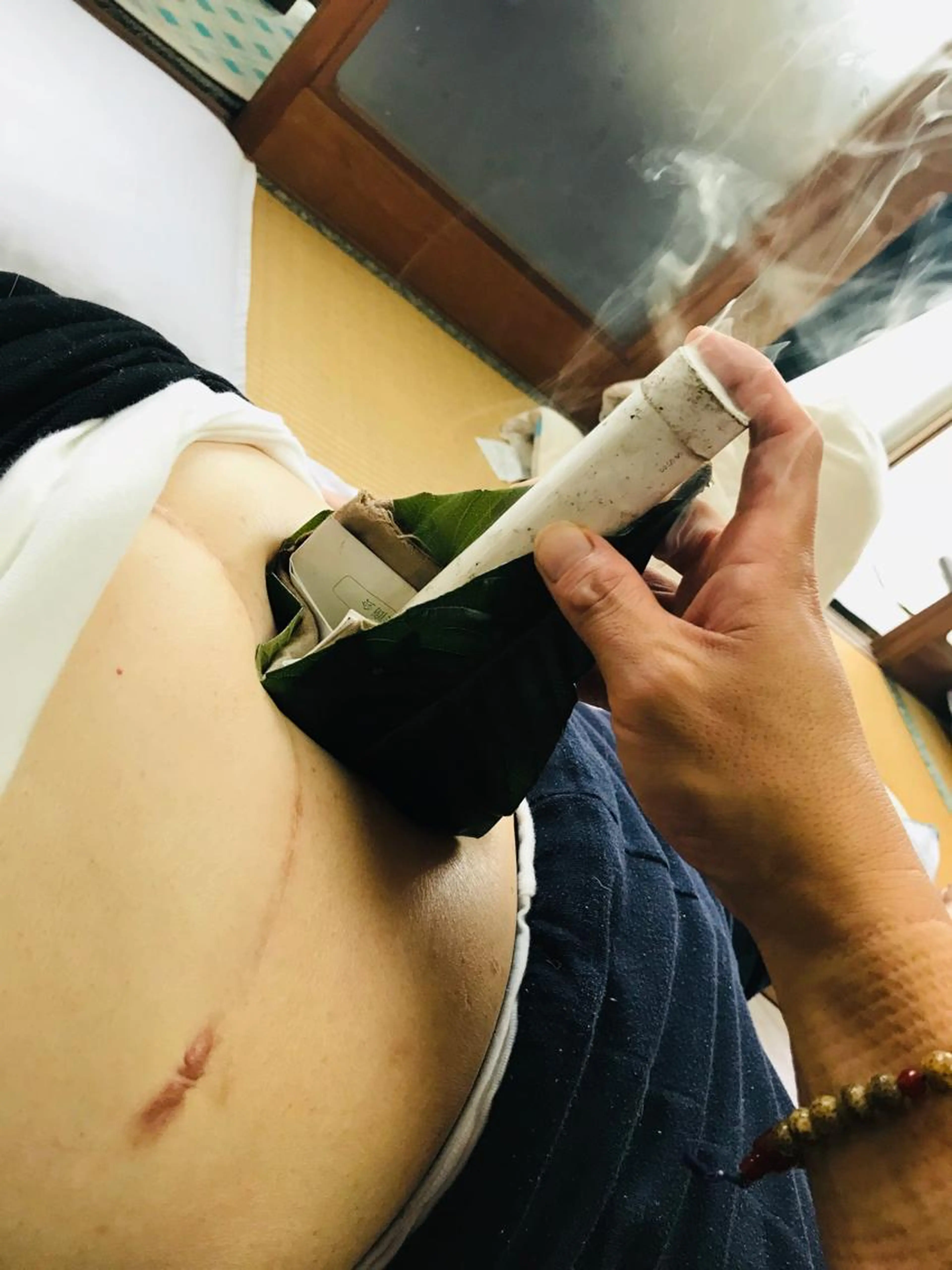 ●枇杷葉療法

   （足湯➕枇杷葉療法➕全身揉みほぐし）

もぐさと枇杷で 身体の芯から温めます。の写真