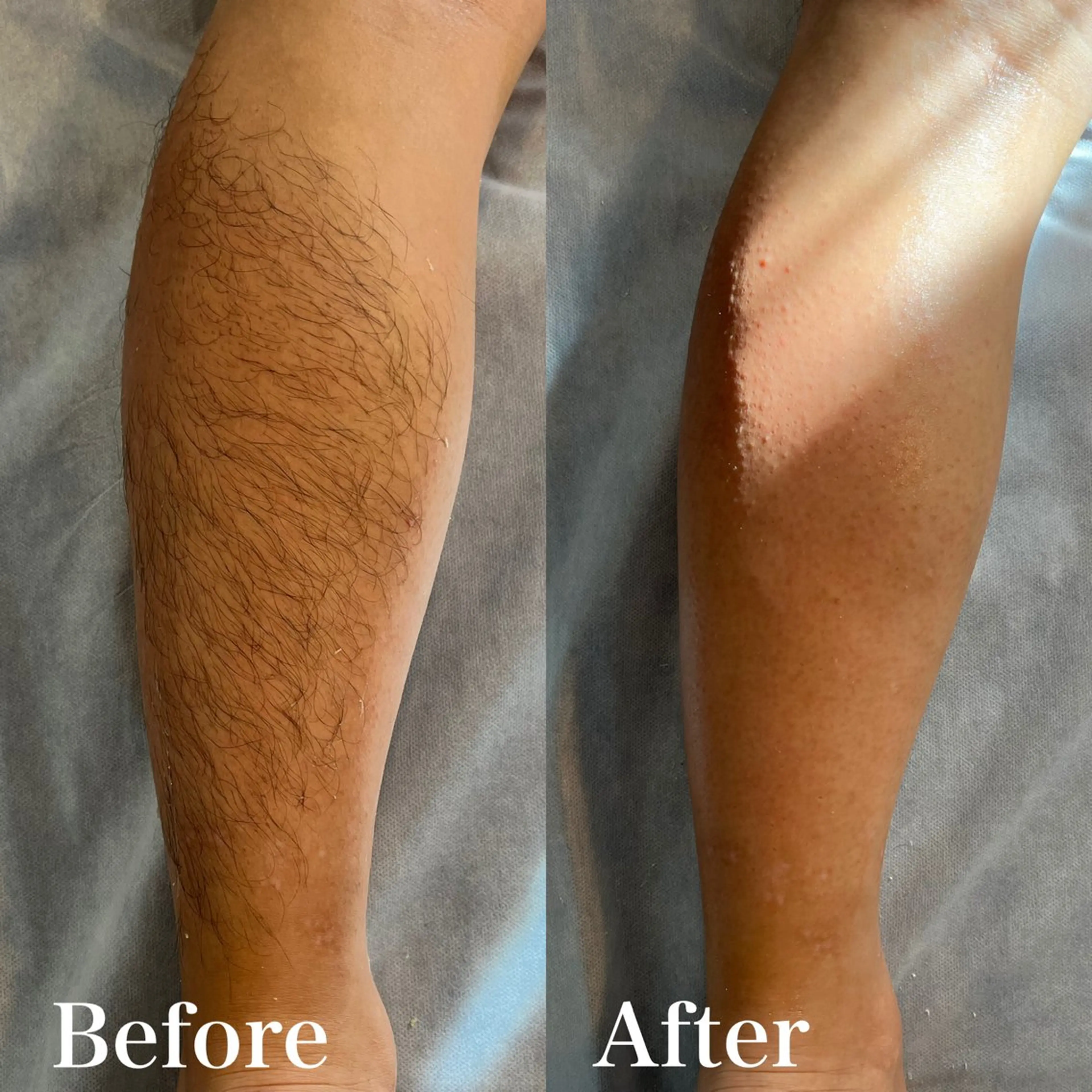 メンズ 脱毛 wax脱毛専門店 ハイラントのエステ・リラクイメージ