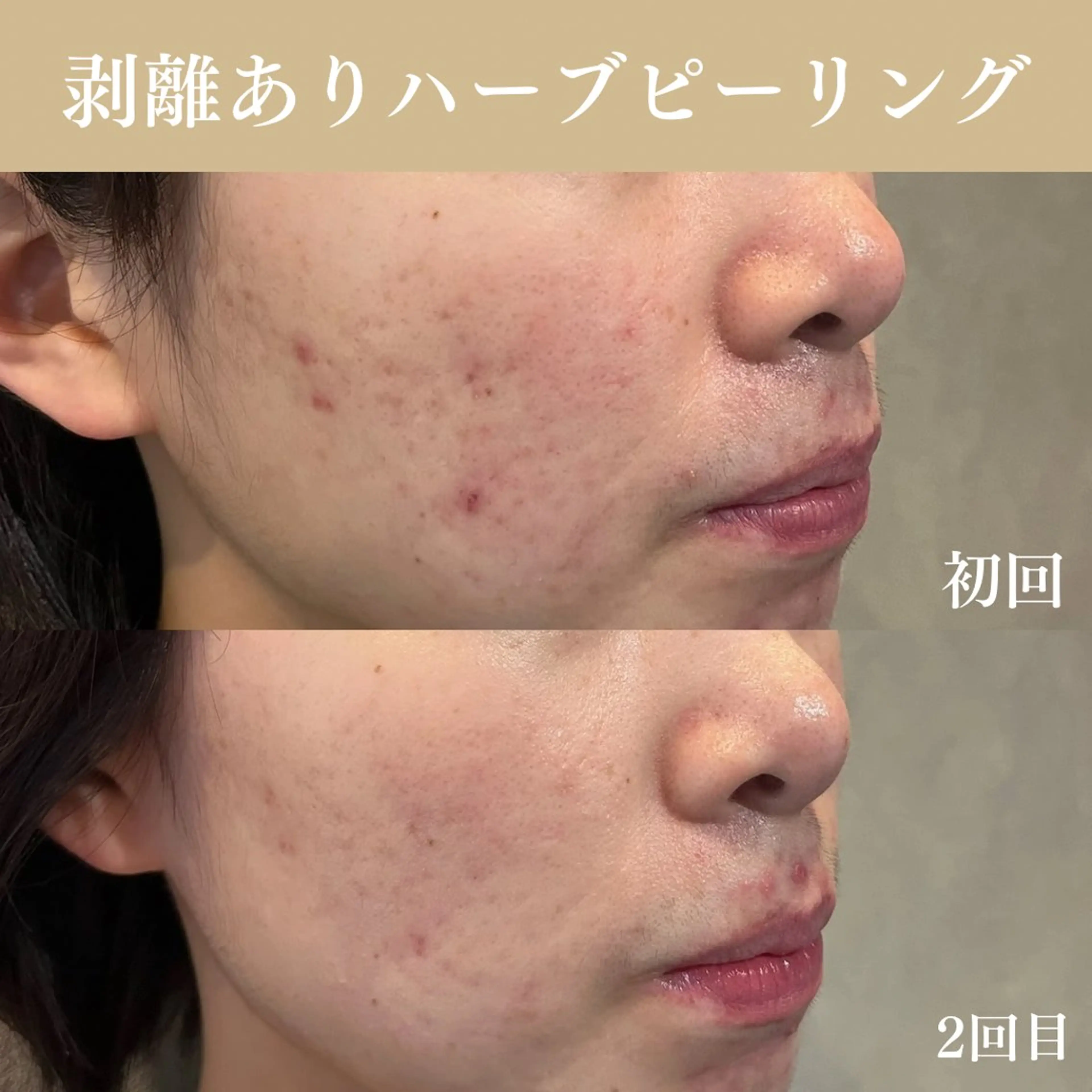 Oncebell. Bodymake&beautysalon所属・Oncebell. ワンベルのエステ・リラクイメージ