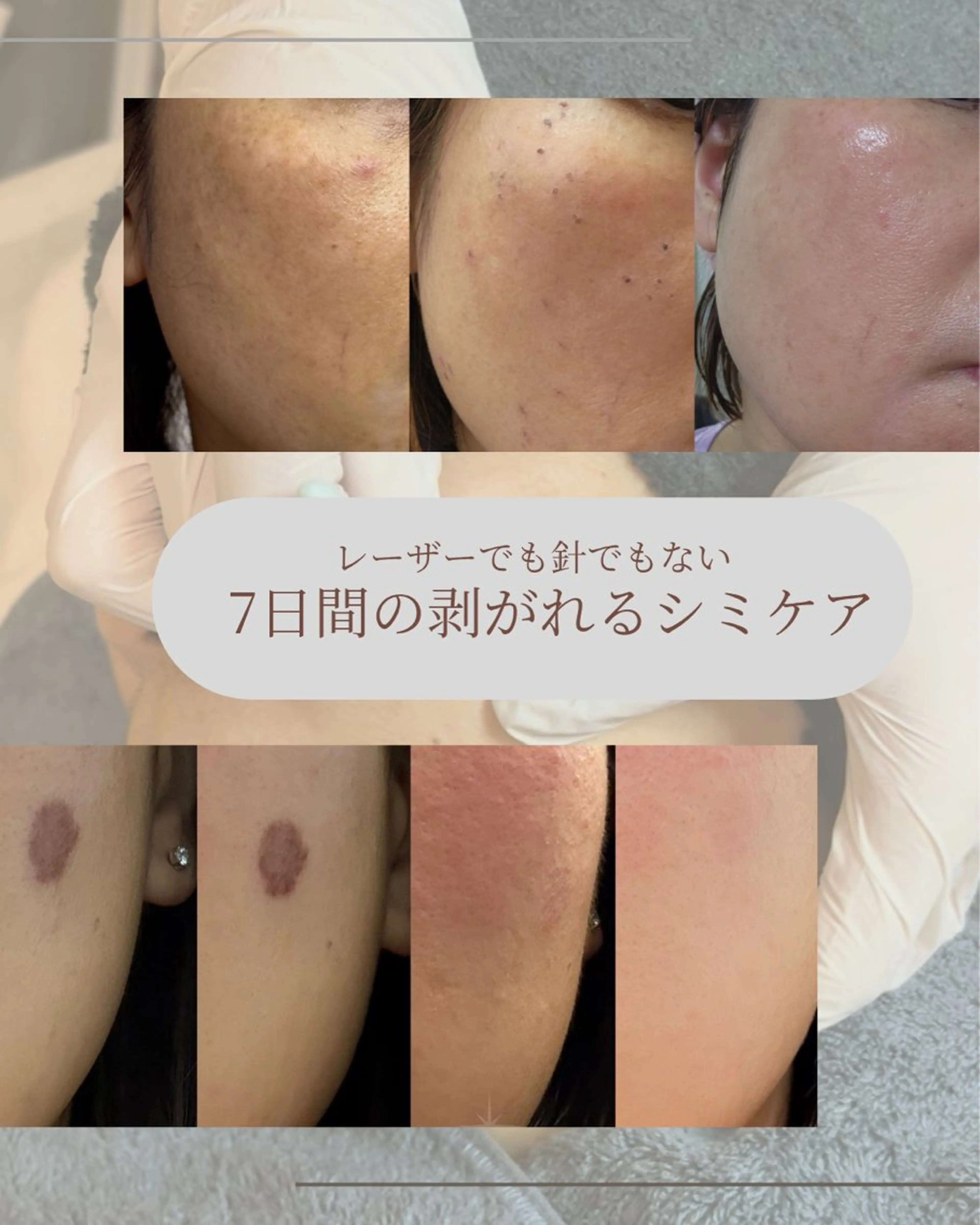 エステ 毛穴が見えなくなるサロン  Horo所属・岡 えり子のエステ・リラクイメージ