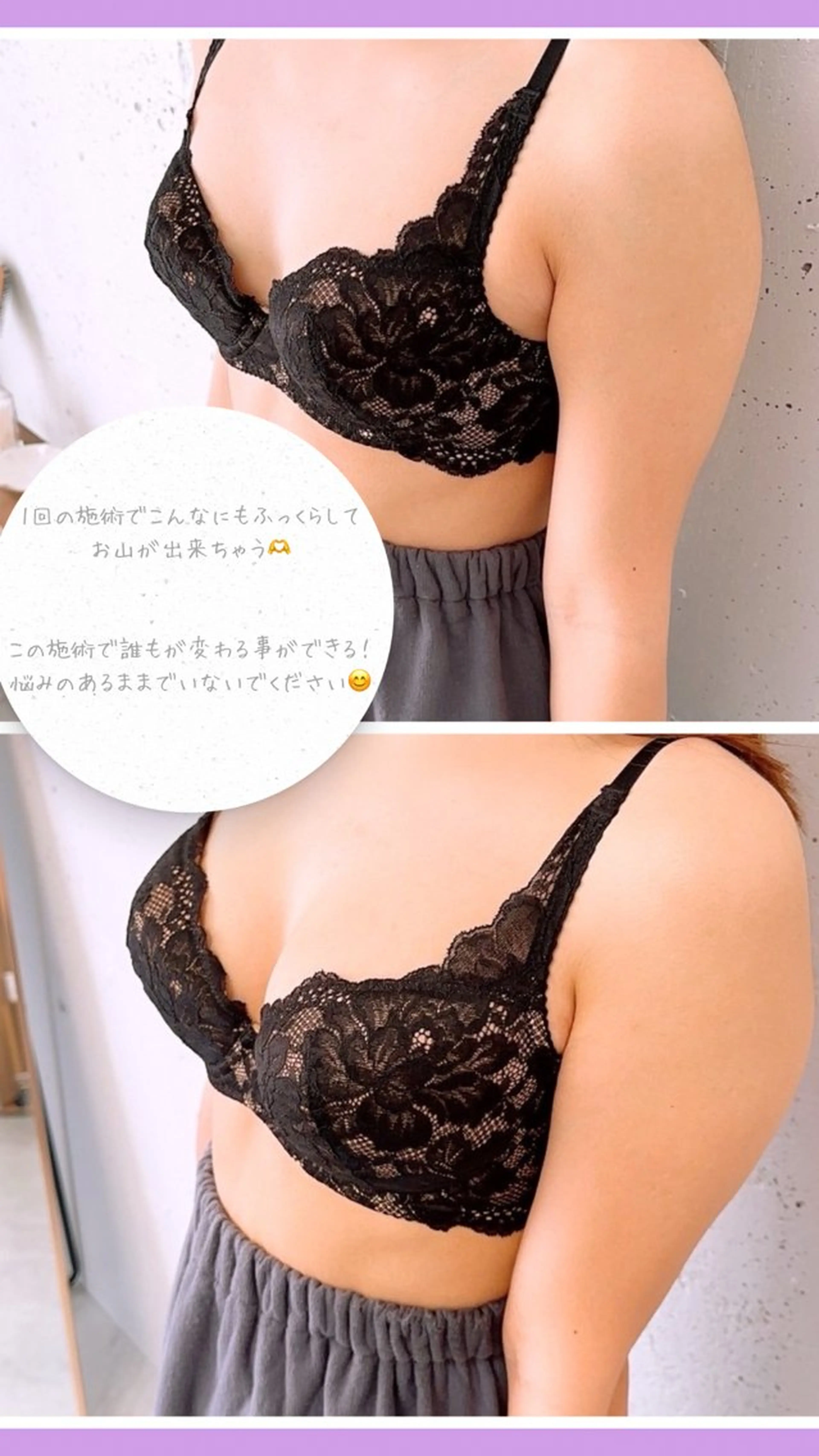 エステ NineTails (ナインテイルズ)のエステ・リラクイメージ