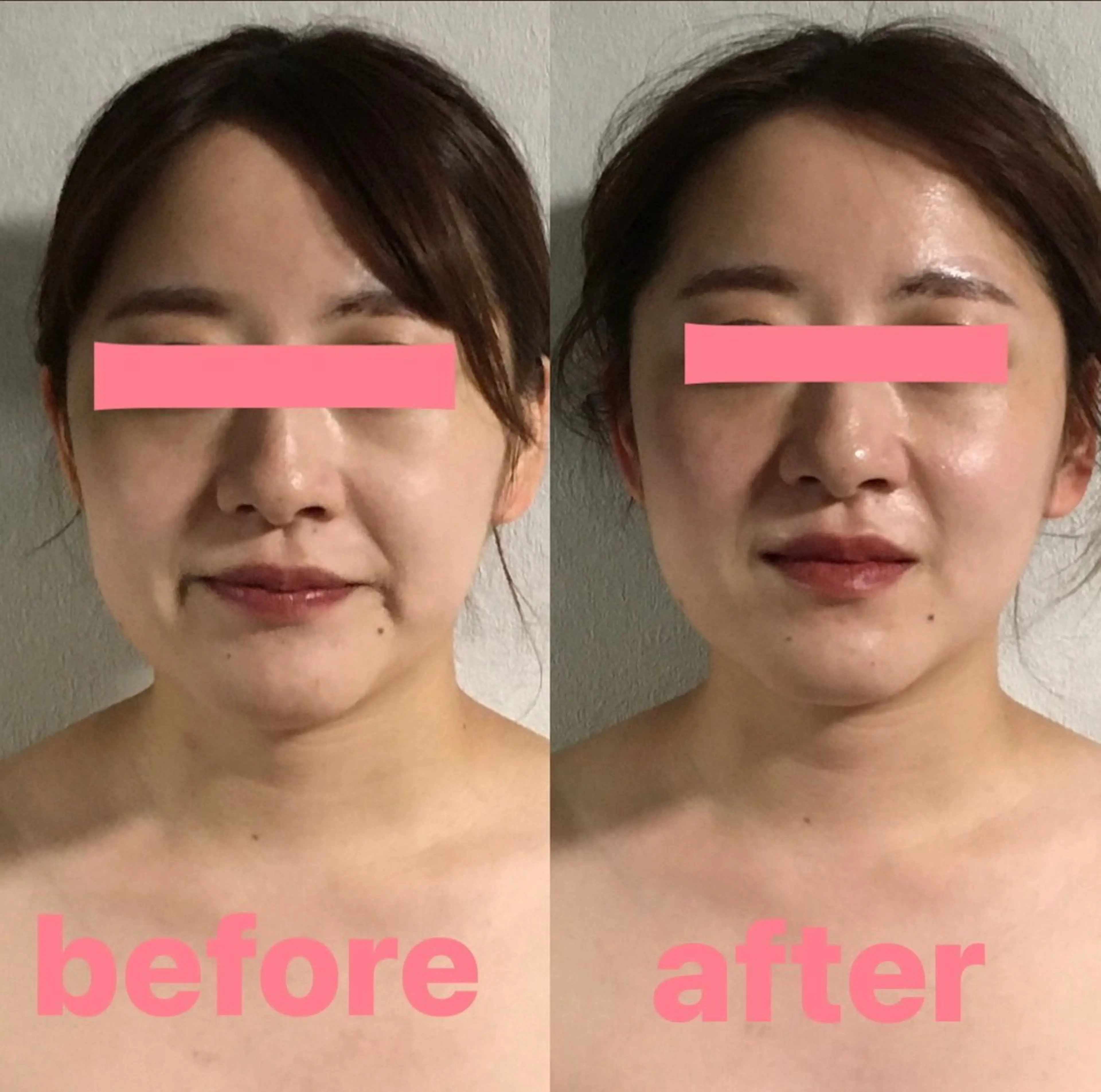 salon de blue rose所属・ハイパーナイフ専門 熊田陽子のエステ・リラクイメージ