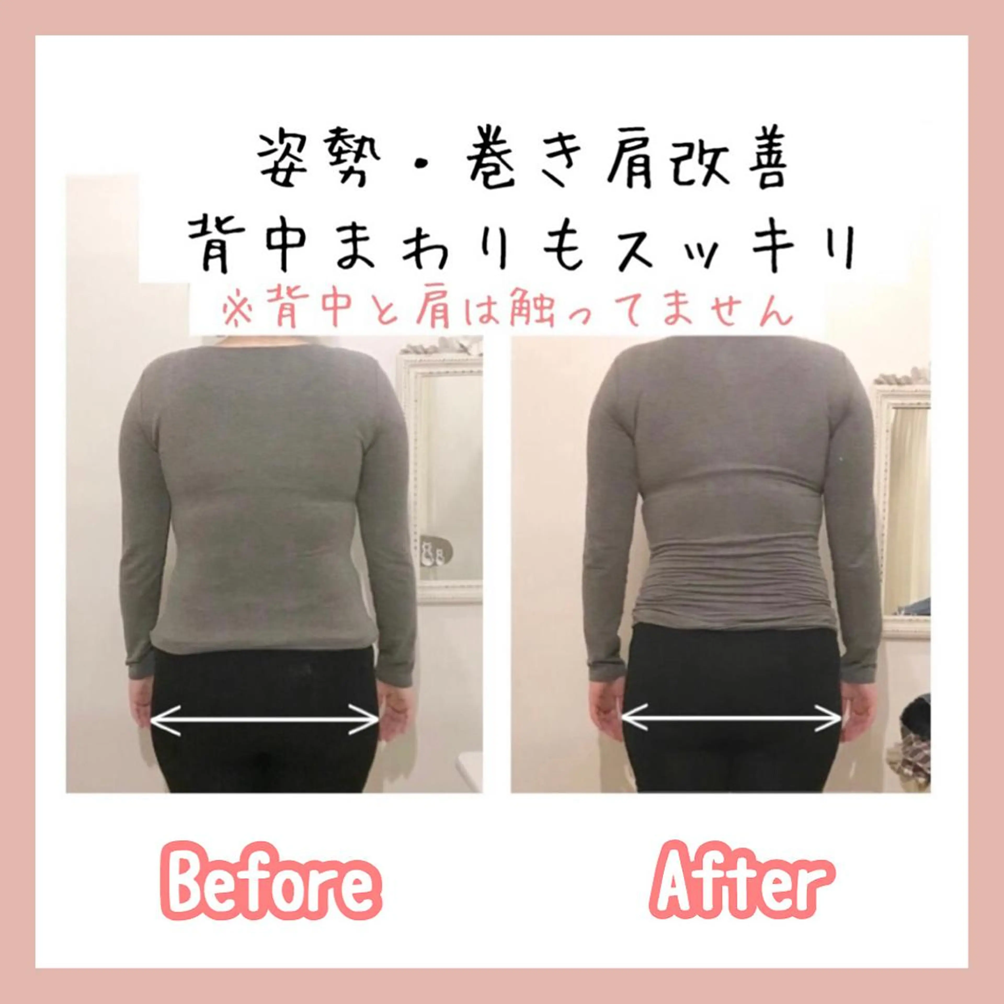 小顔モニター 募集のエステ・リラクイメージ