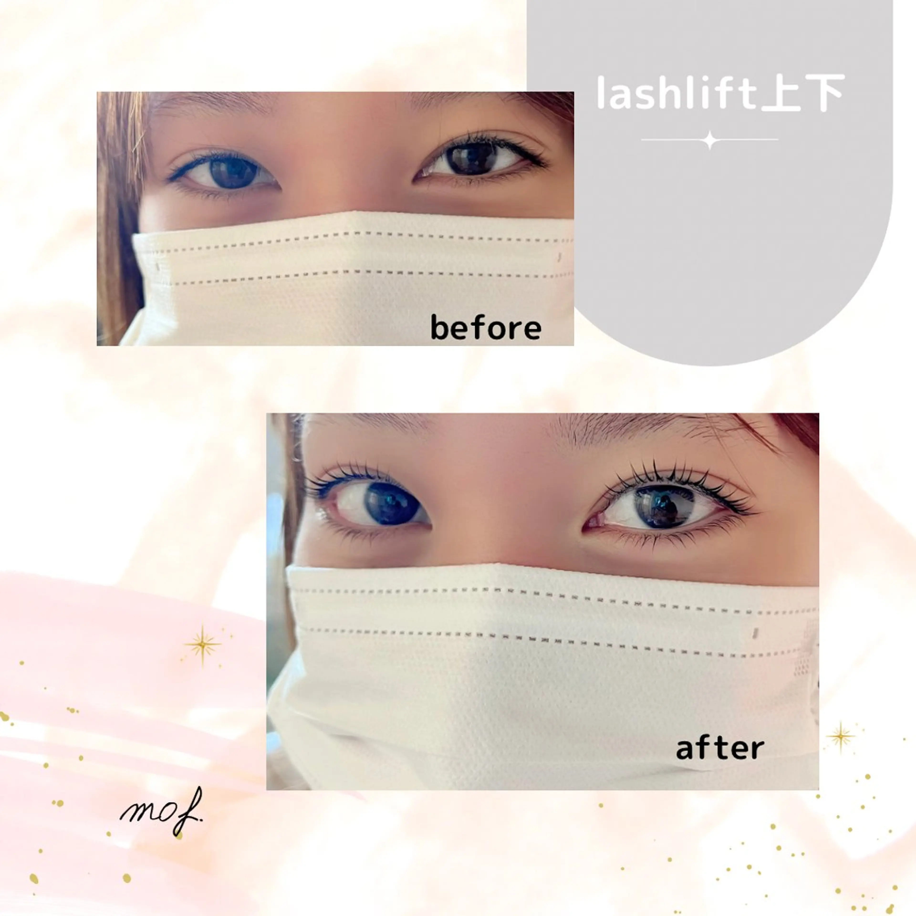 🐰上下まつ毛パーマで中顔面短縮効果◎ まつ毛パーマ上下🌼　ラッシュリフト　マツパの写真