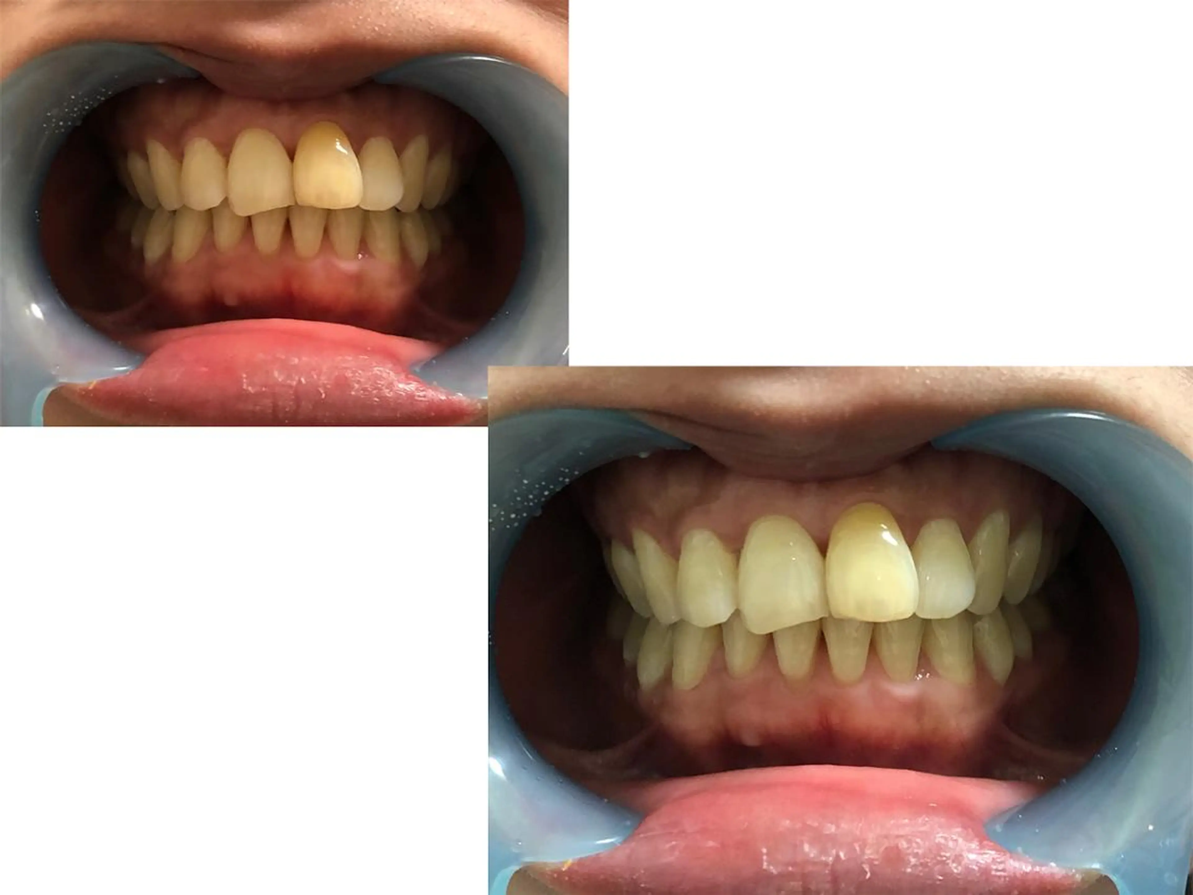 ミディアム ヘアアレンジ ネイル マツエク・マツパ メンズ カラー パーマ キッズ アイブロウ ビジネス メンズ就活ヘア ホワイト 中目黒 ホワイトニングサロンのその他イメージ