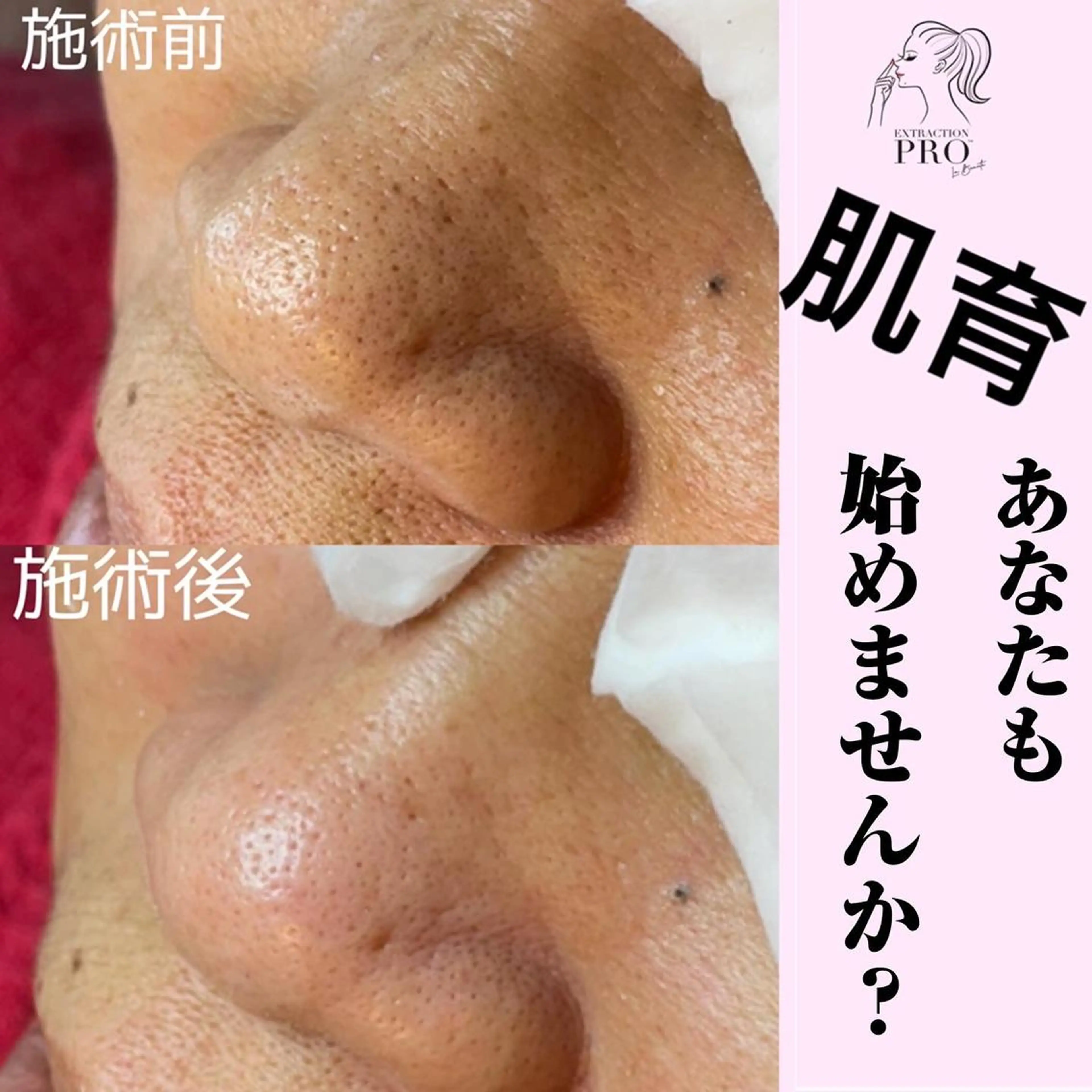 Mignon +所属・Mignon + Natsukiのマツエク・マツパデザイン