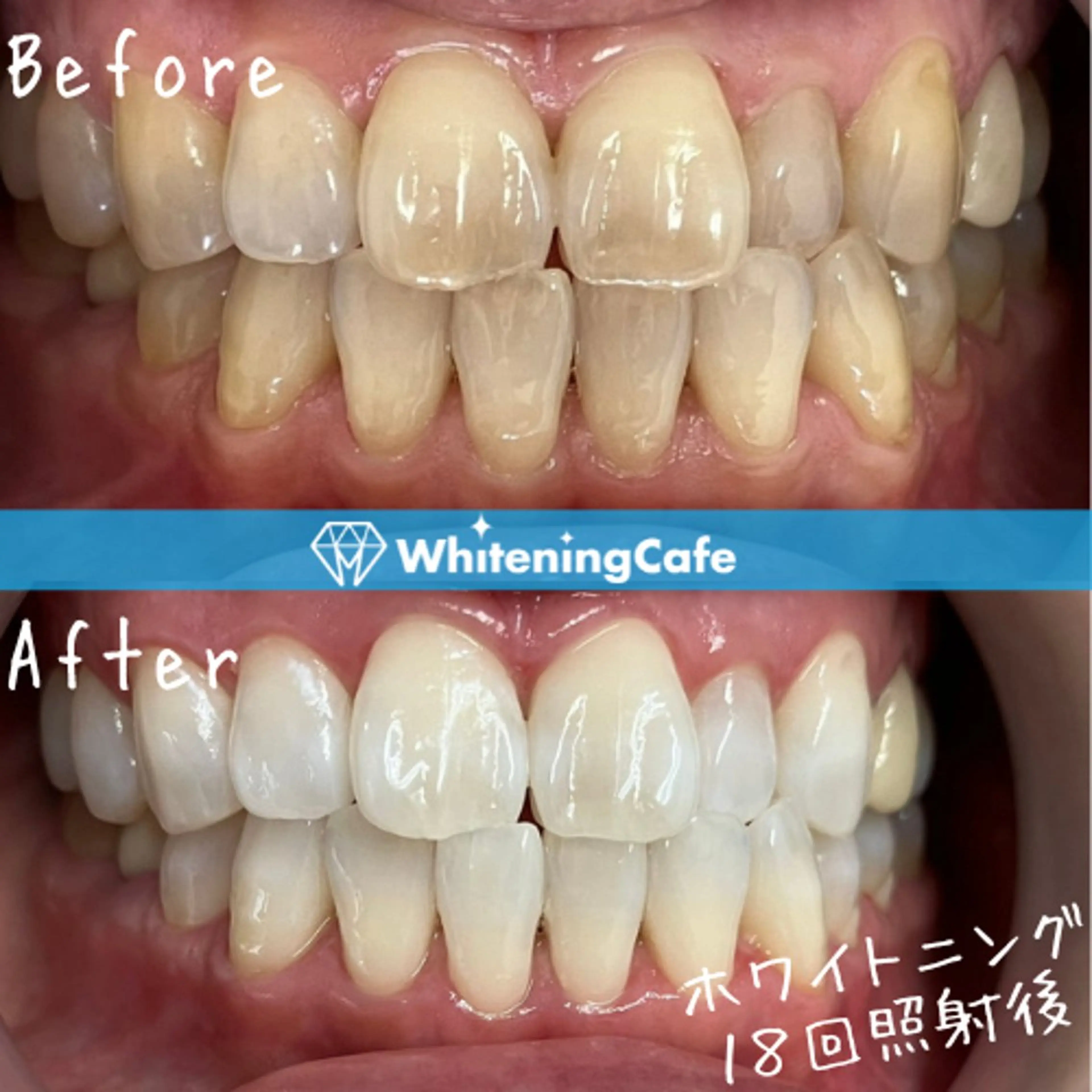 ホワイトニングカフェ徳島沖浜店所属・ホワイトニングカフェ 徳島沖浜店のエステ・リラクイメージ