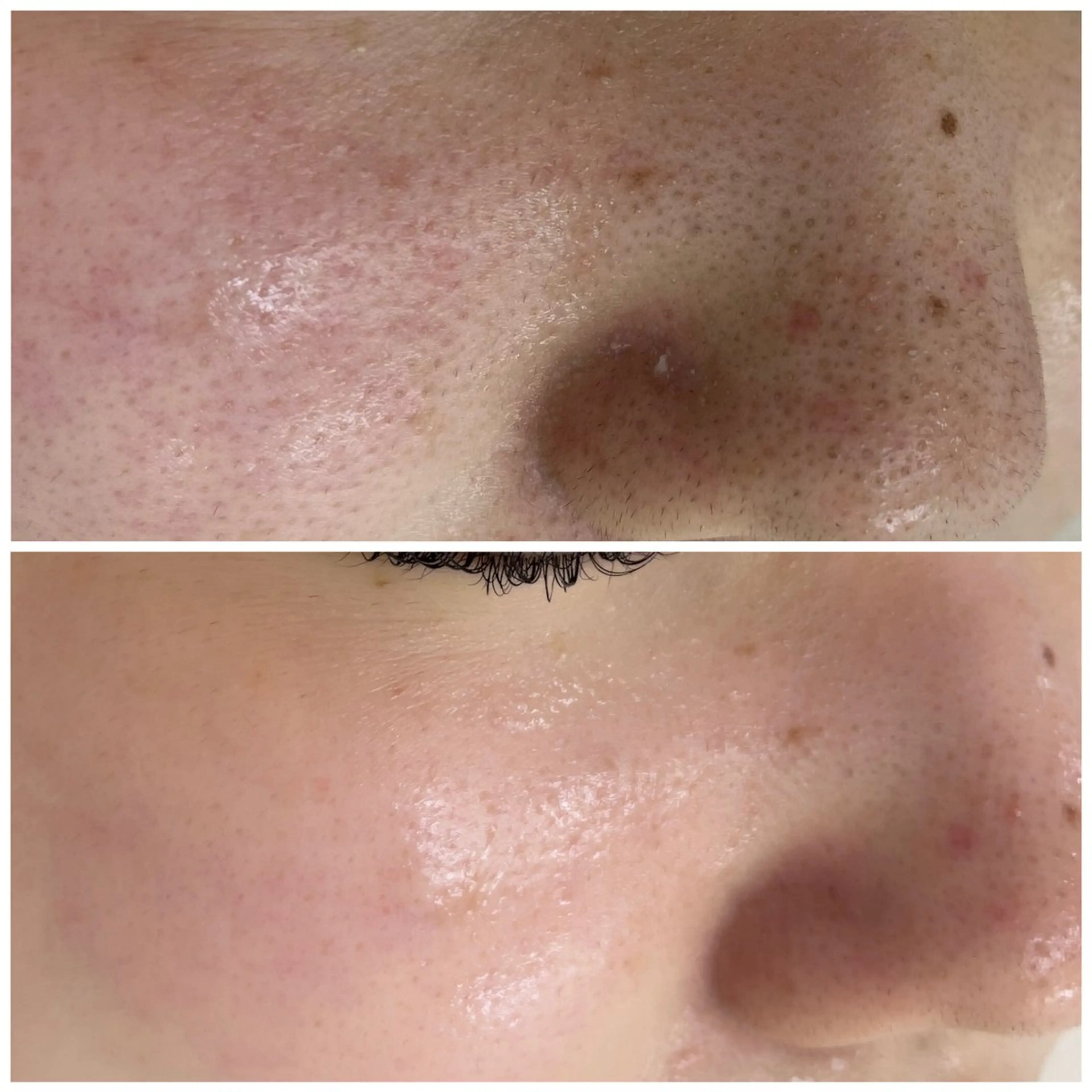 CEサロンblanc bebe所属・高村 有紀のエステ・リラクイメージ