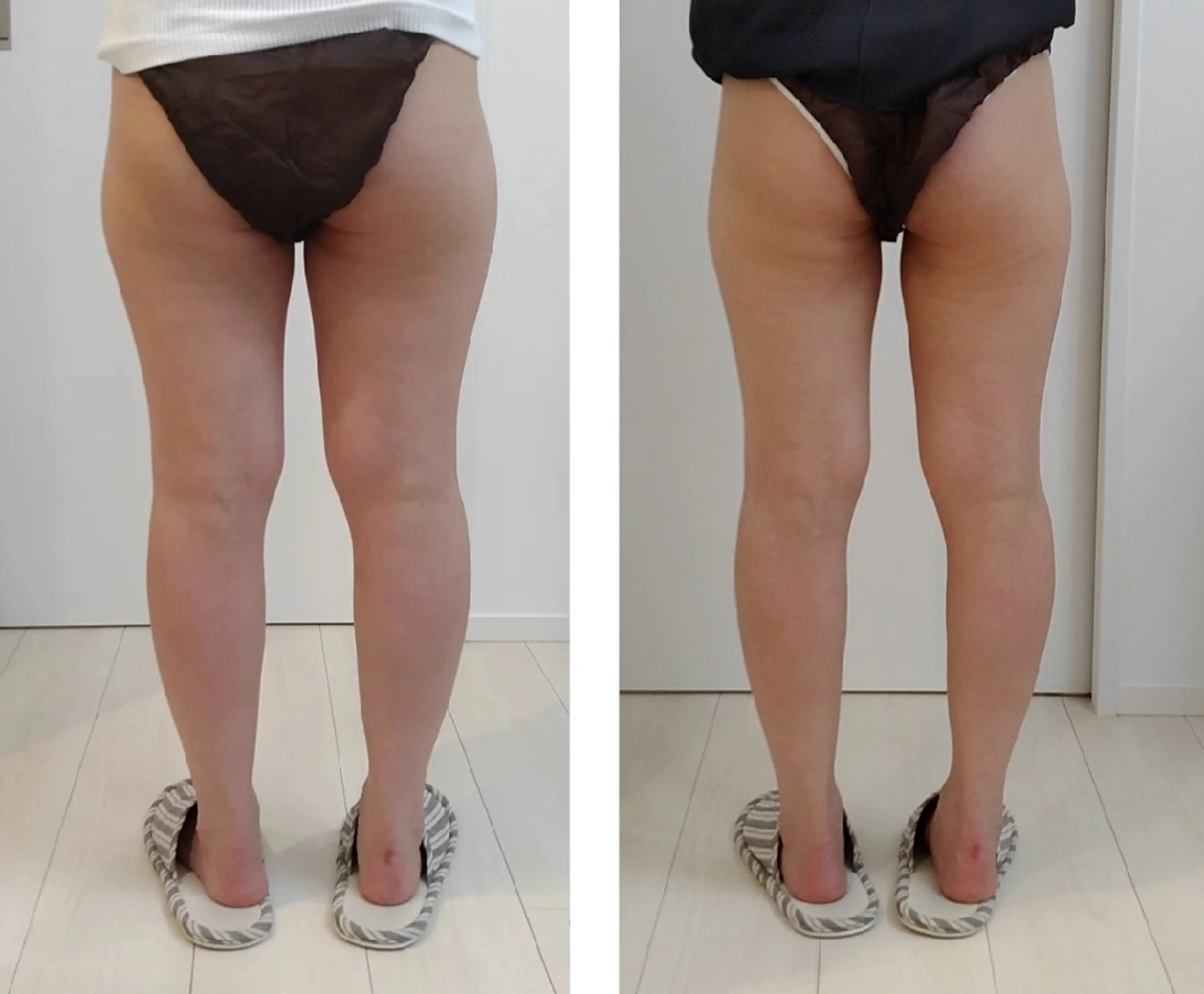 エステ リラク ユニセックスエステサロンUniclear所属・痩身&フェイシャル Uniclearのエステ・リラクイメージ