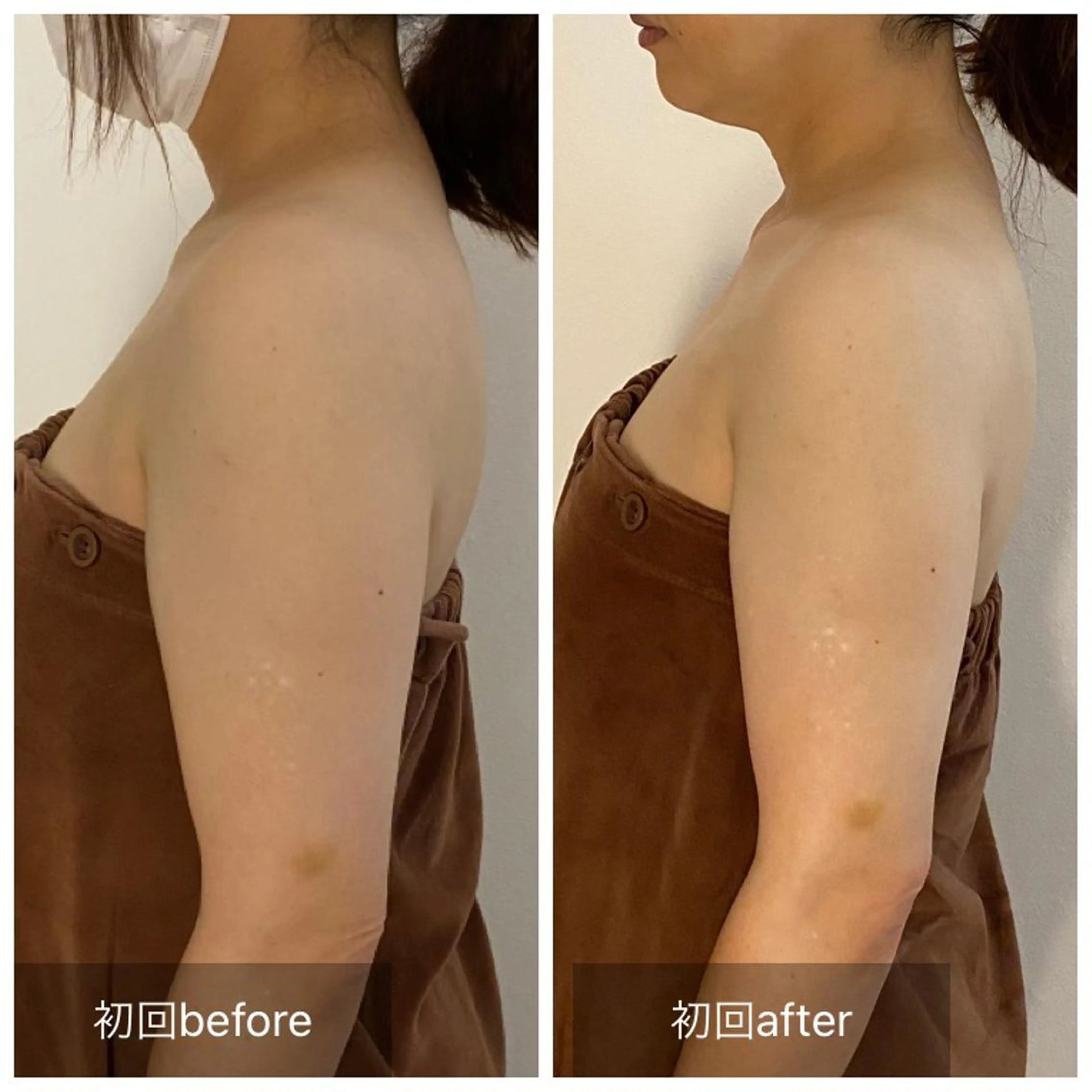 日常生活は巻き肩になるような姿勢が非常に多いです😭痛くない施術方法で、巻き肩にアプローチ❤️の写真