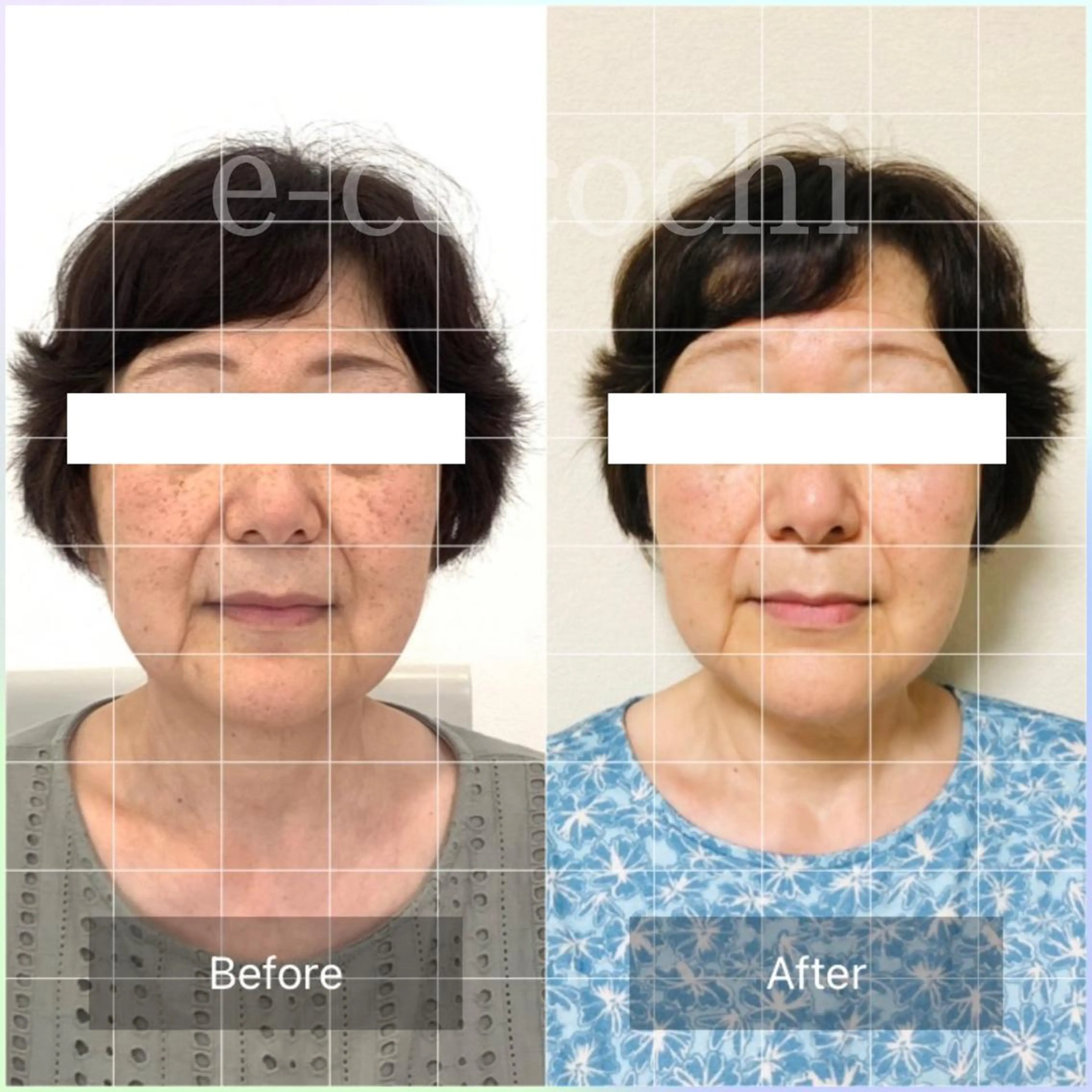 エステ リラク 小顔と ヘッドスパのお店のエステ・リラクイメージ