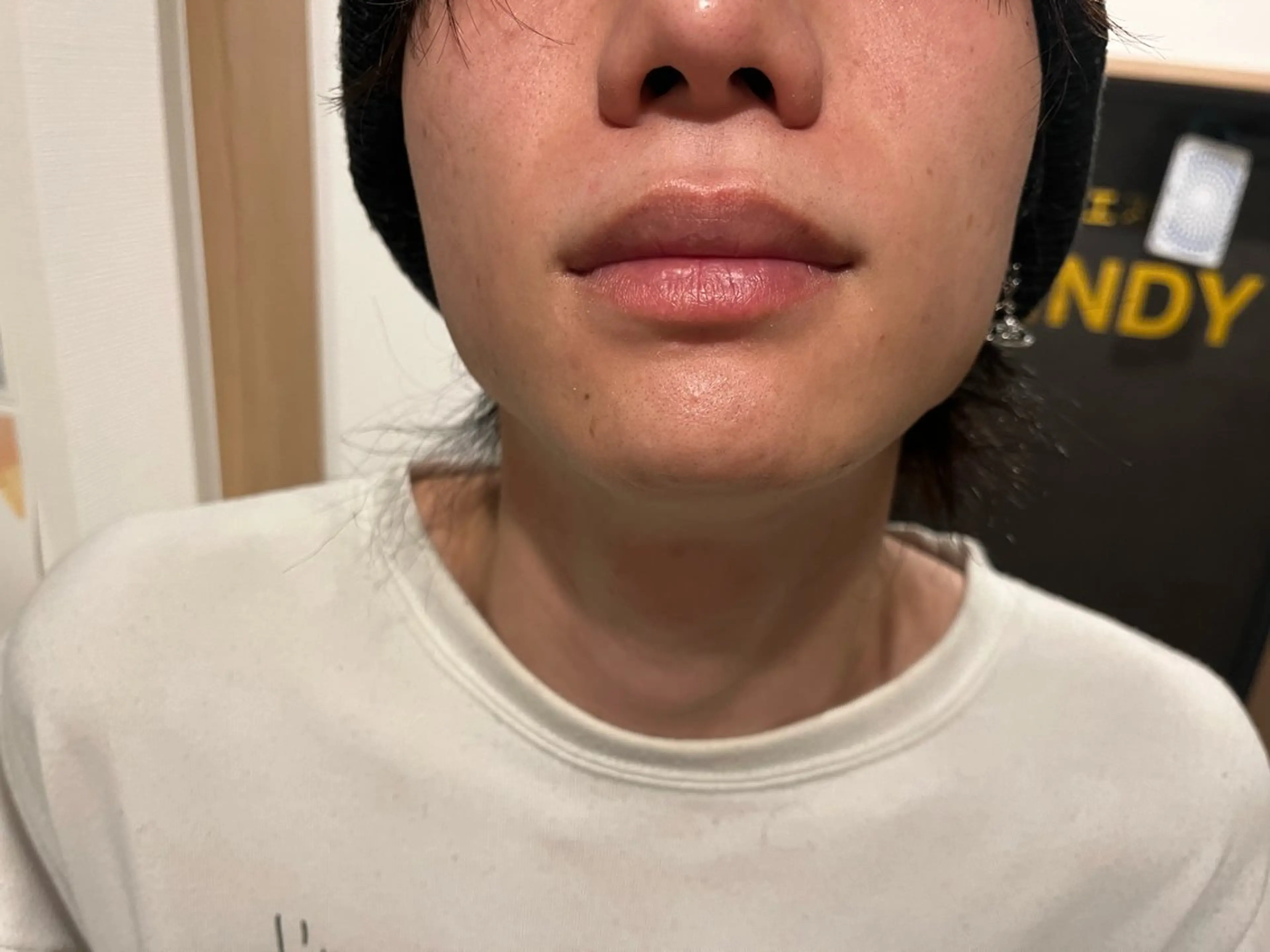 メンズ エステサロン lindyのエステ・リラクイメージ