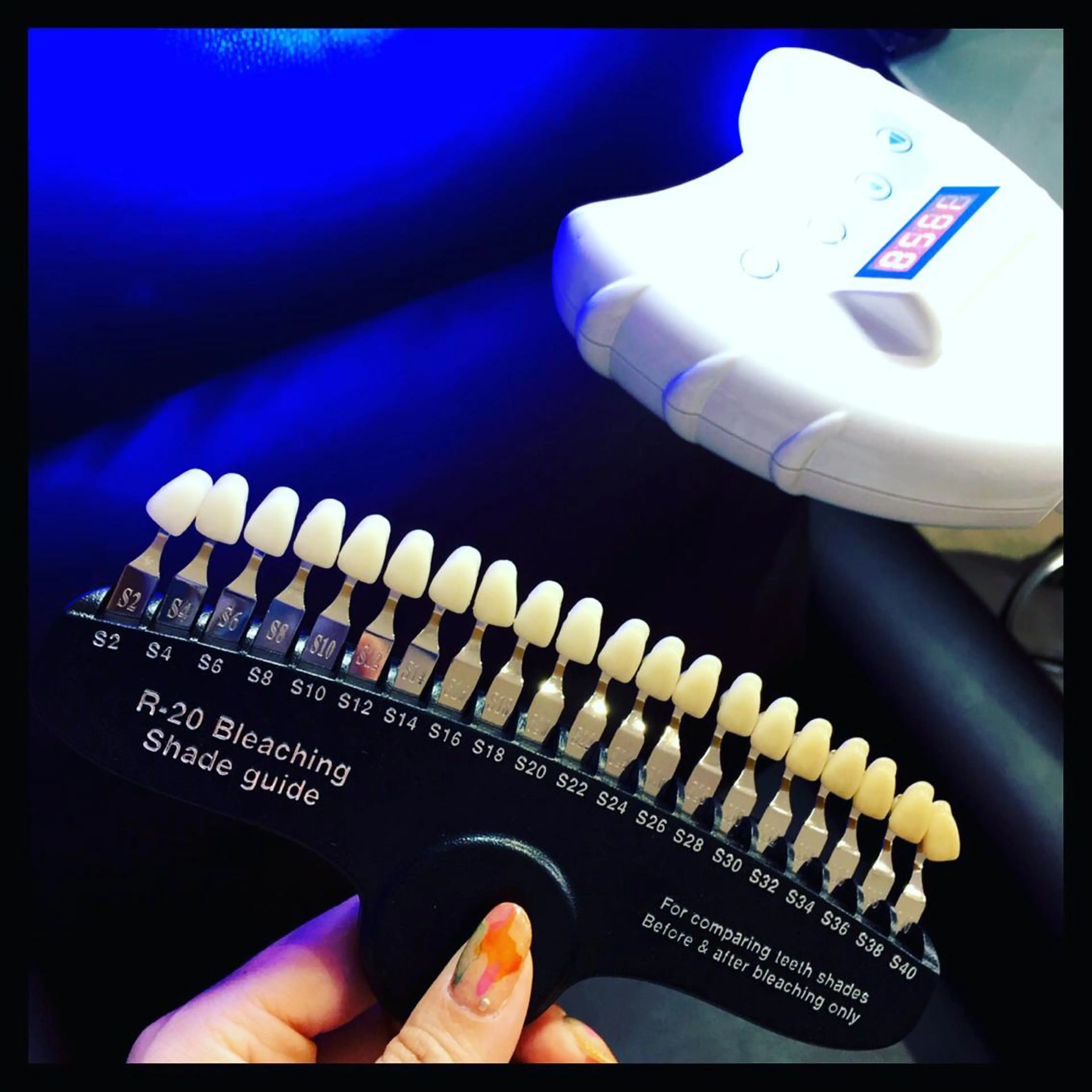 【なるべく早く歯を白くみせたい方へ☆】セルフホワイトニングで汚れ除去の写真