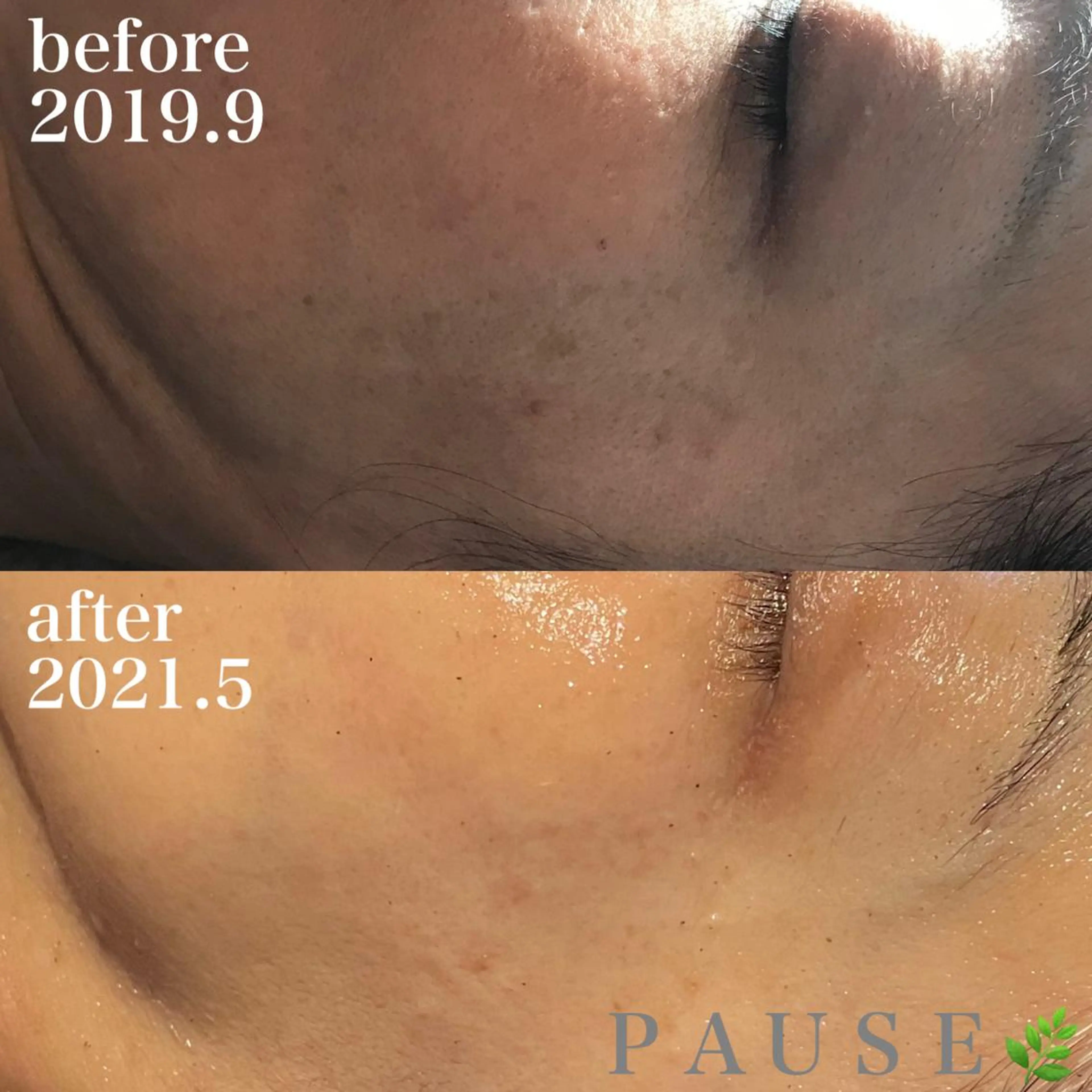 エステ 浜野 恵美のエステ・リラクイメージ