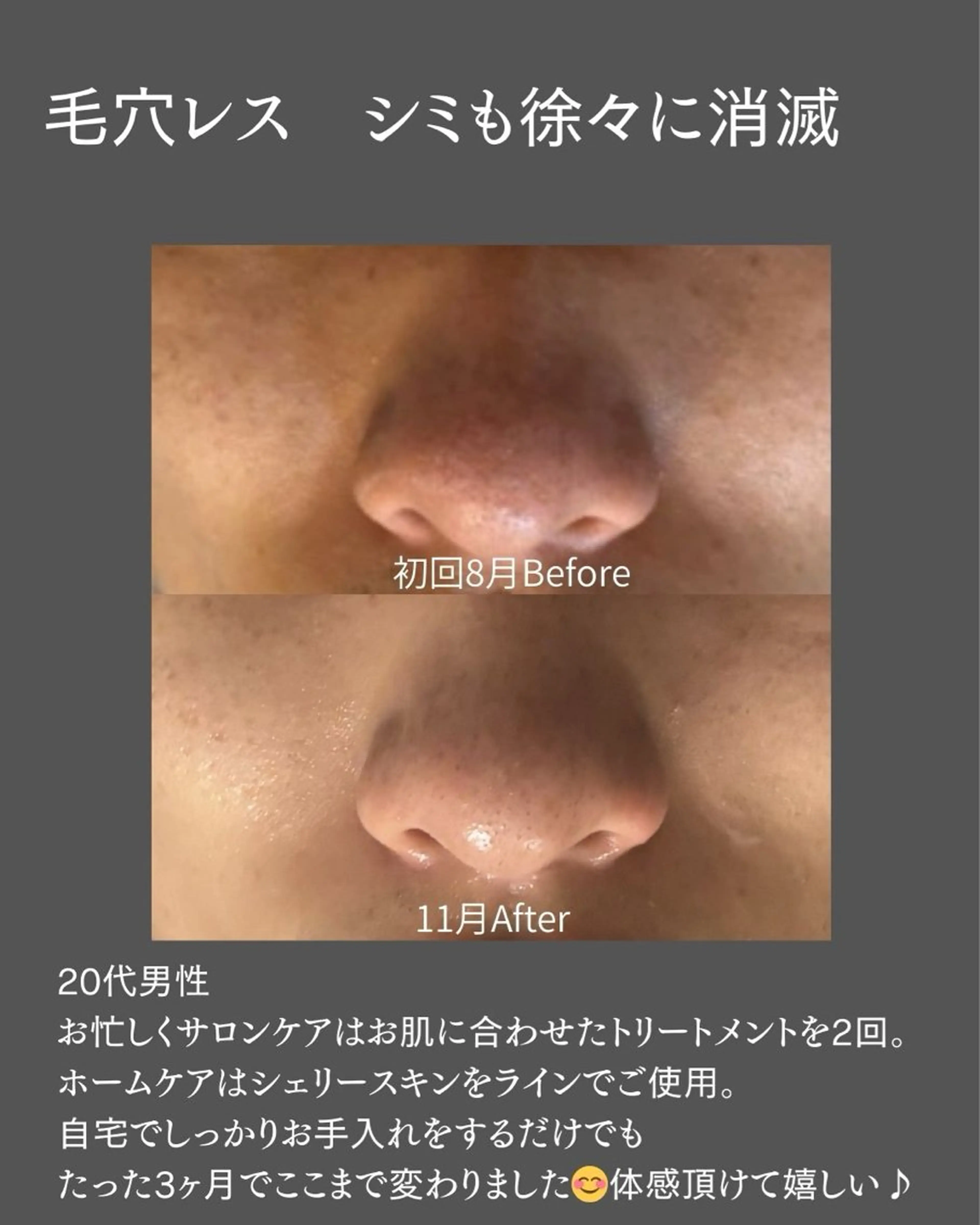 salon BLOSSOMのエステ・リラクイメージ