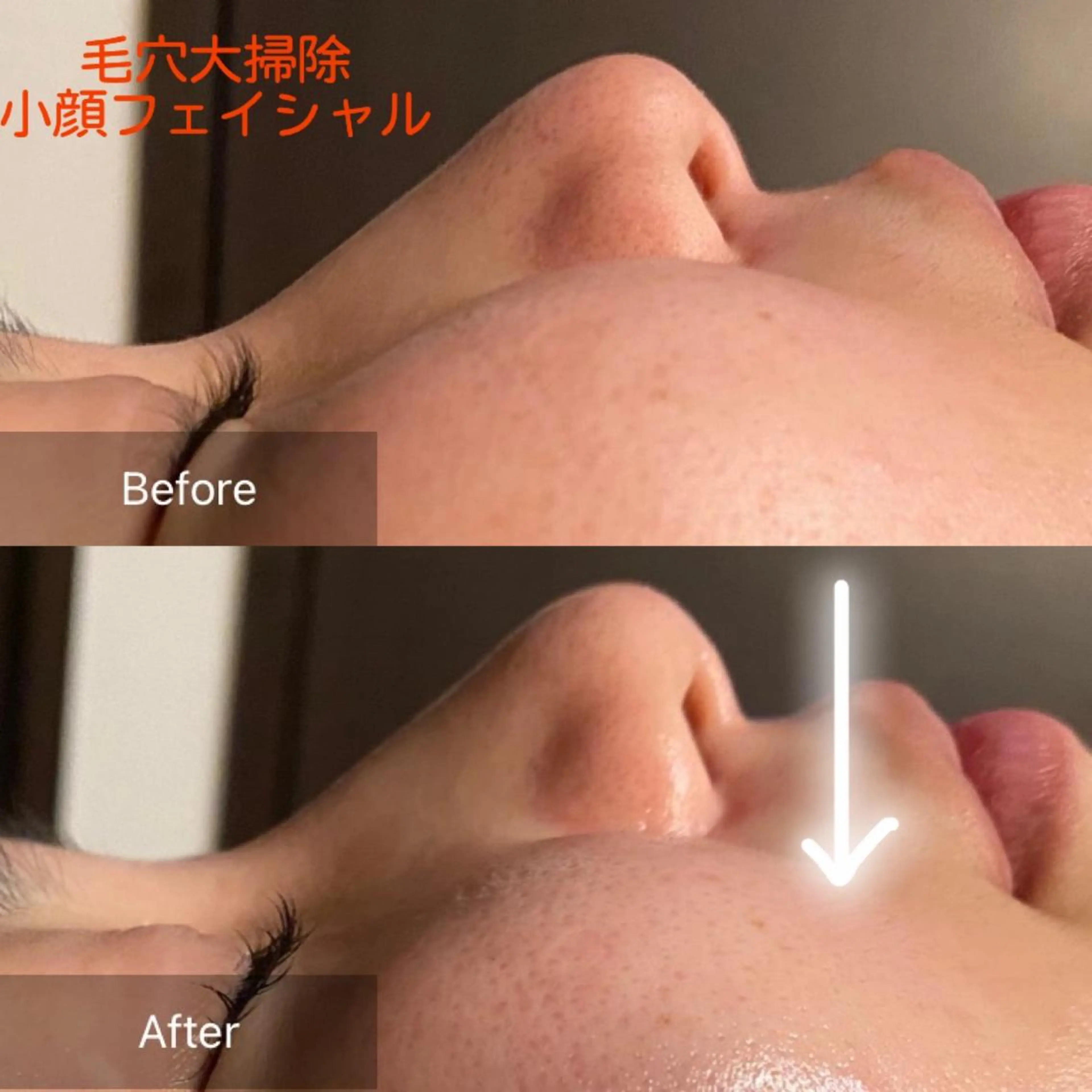 Mandarin Orange所属・毛穴から始める肌メン テマンダリンオレンジのエステ・リラクイメージ