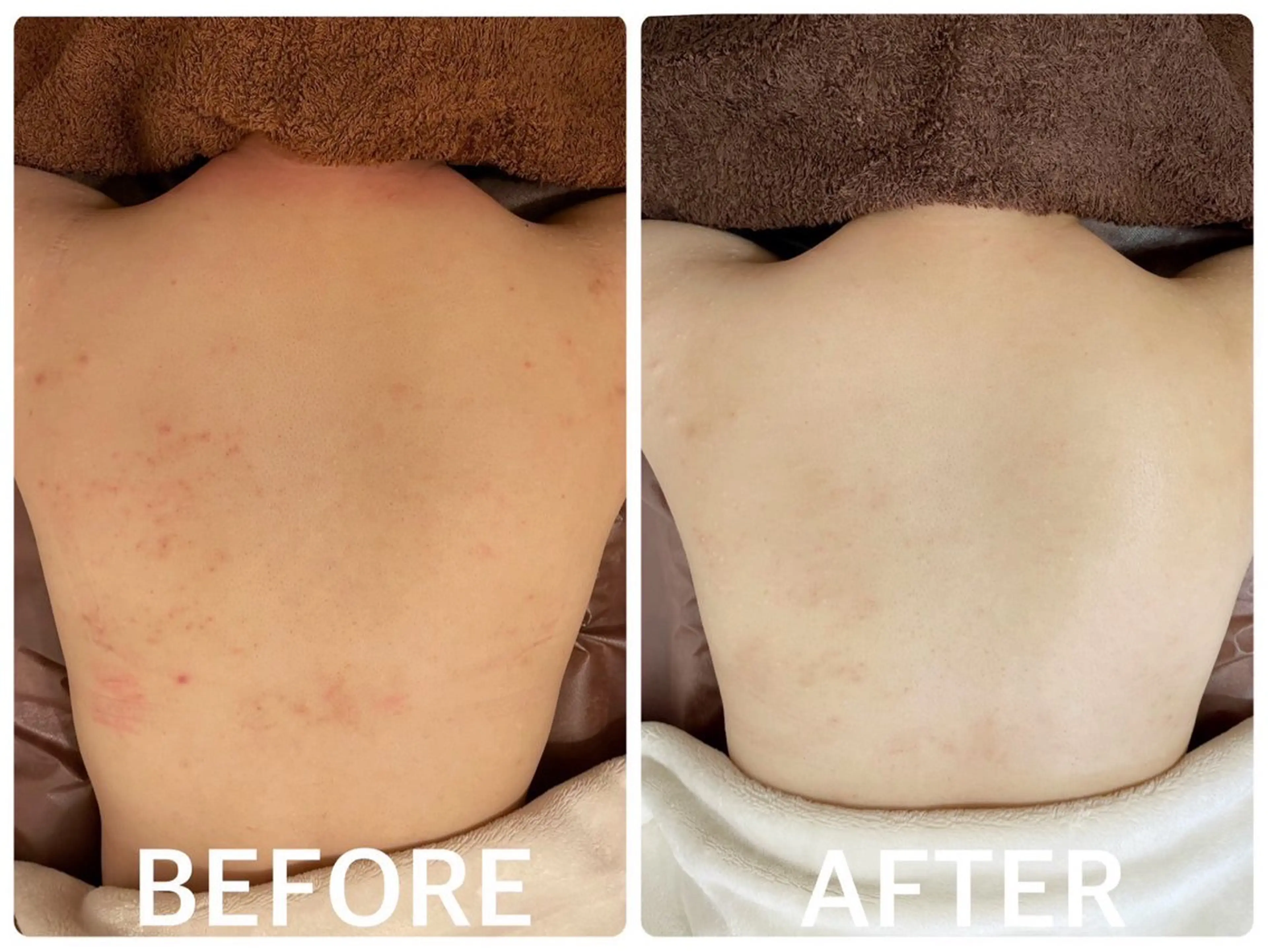 ハーブピーリング 横浜のエステ・リラクイメージ